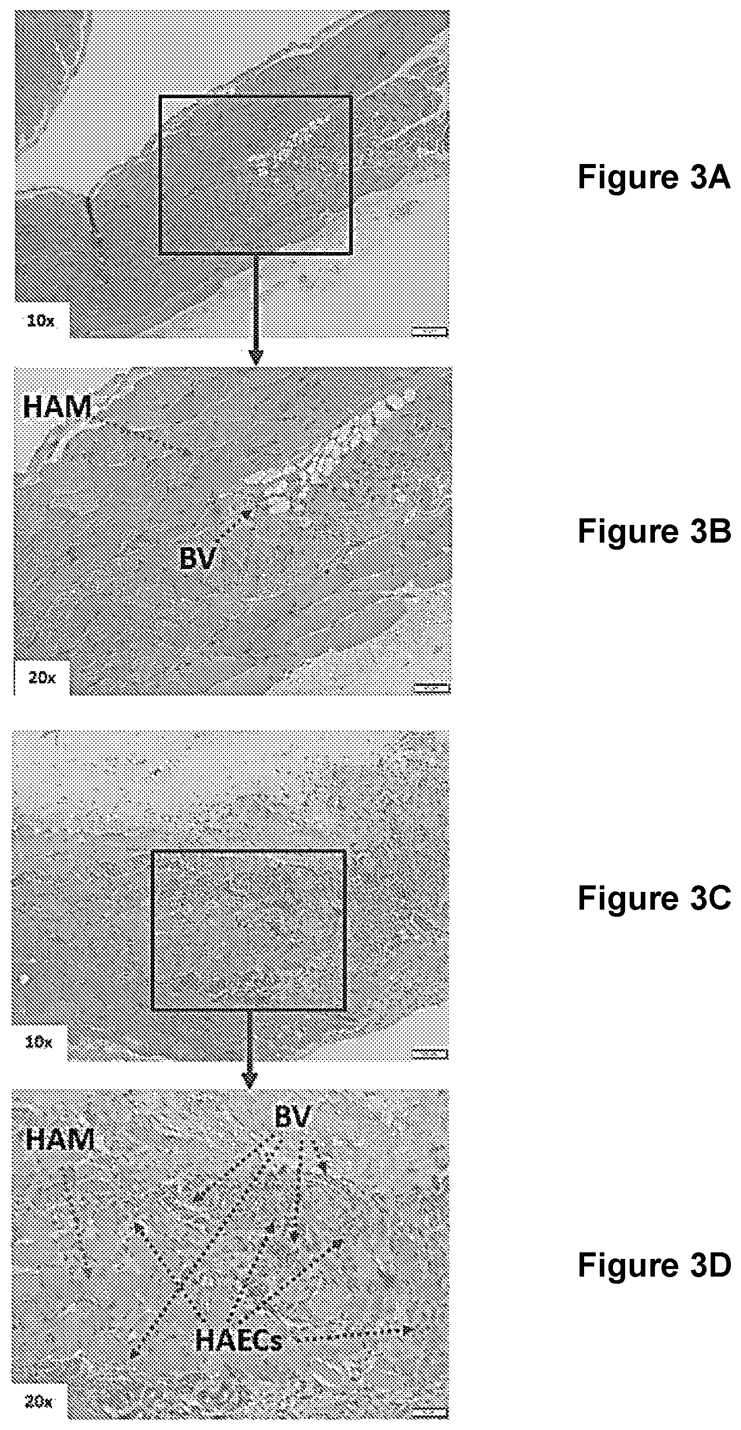 Patent US12311078 Figure 3 – Methods and compositions for cell transplantation