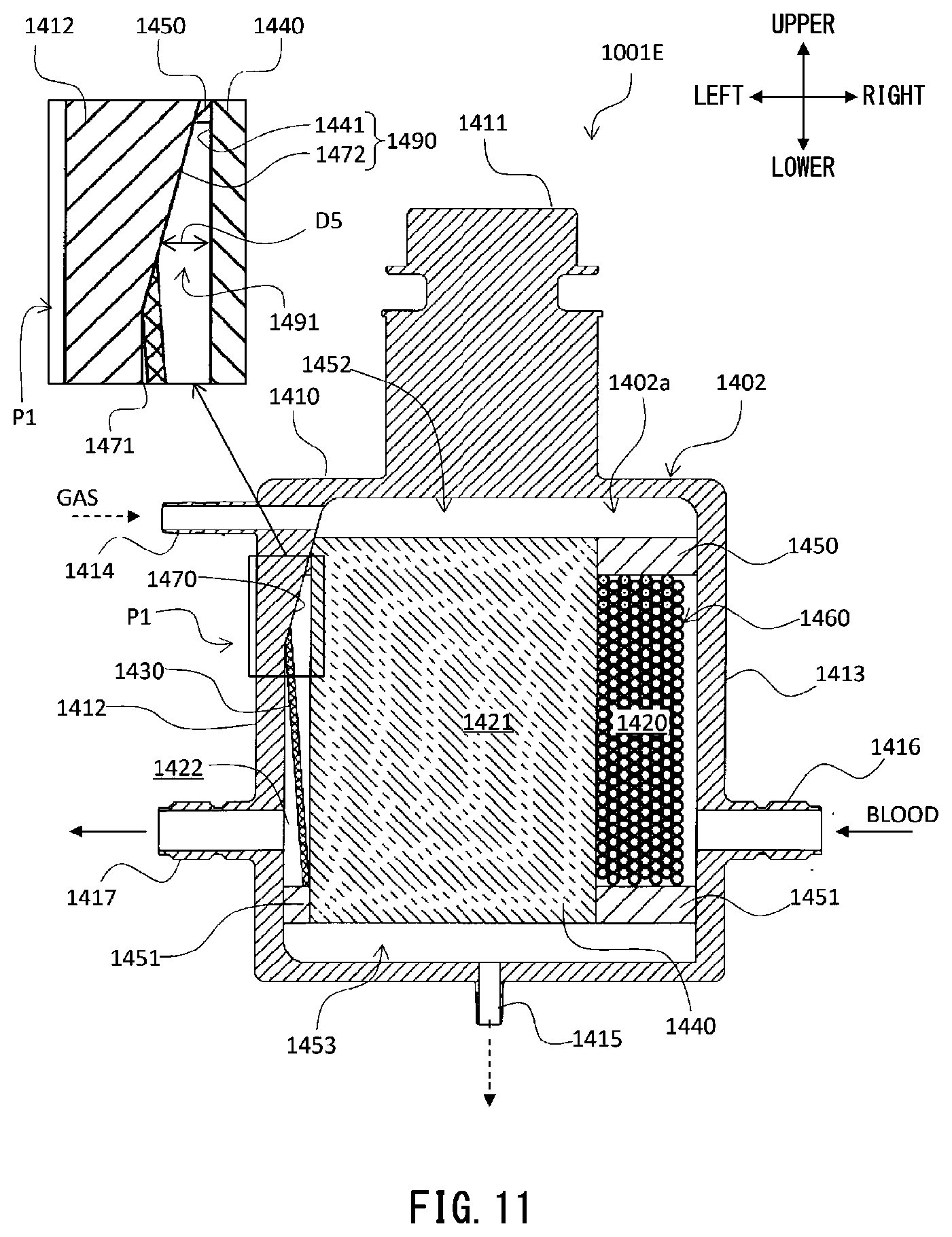 Patent US12311088 Figure 11 – Artificial lung device