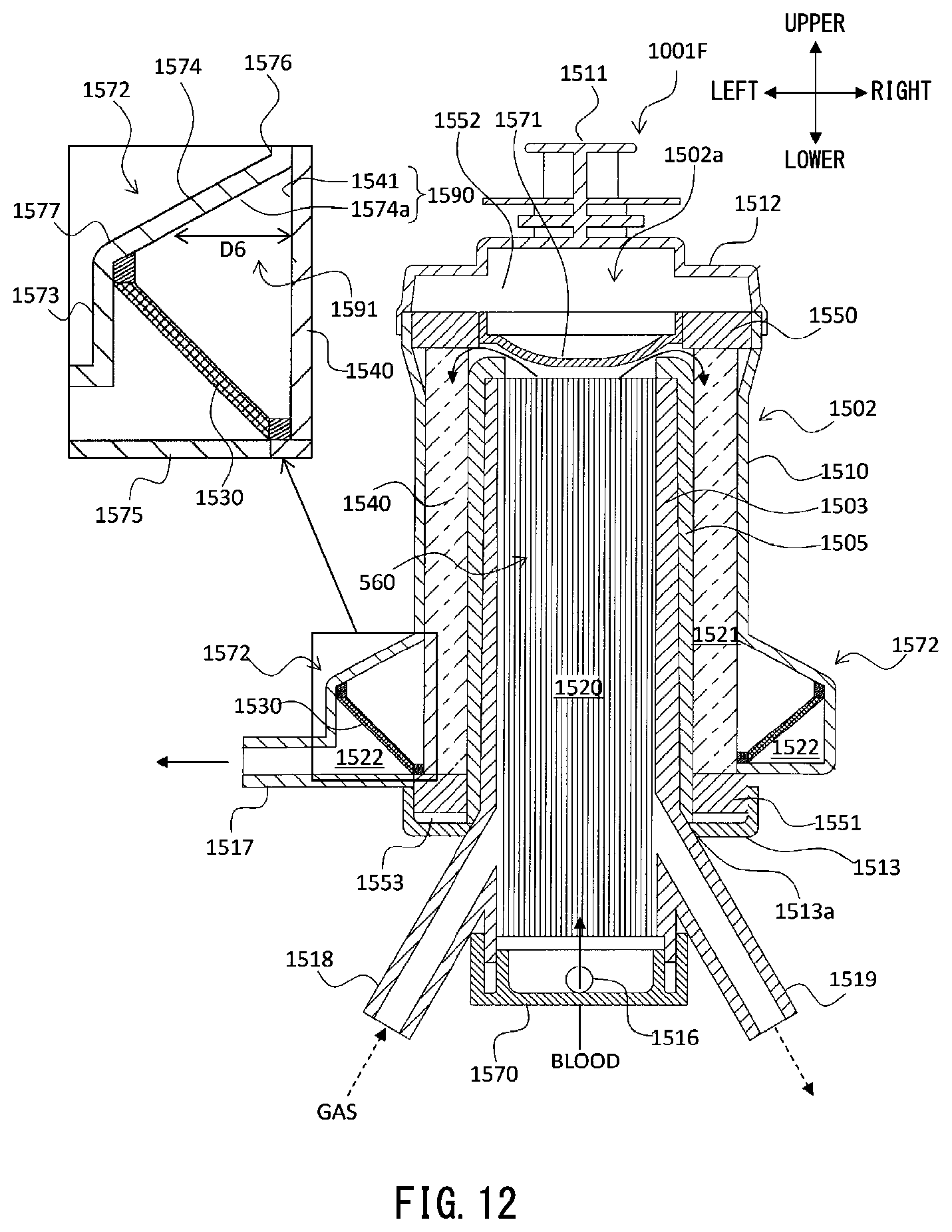 Patent US12311088 Figure 12 – Artificial lung device