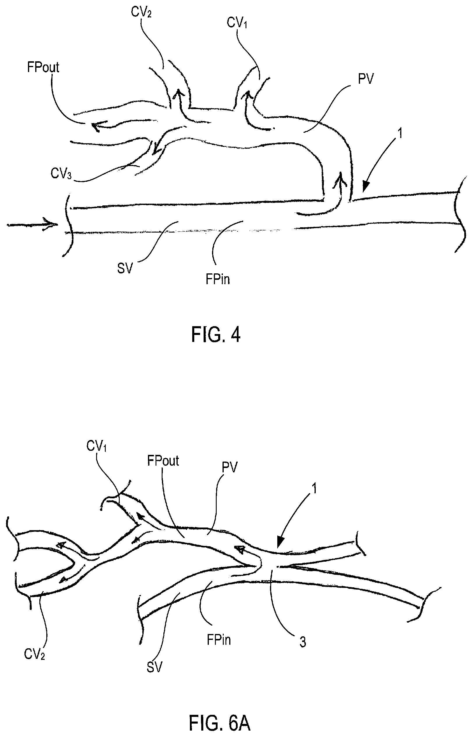 Patent US12311092 Figure 4 – Vascular flow control devices and methods