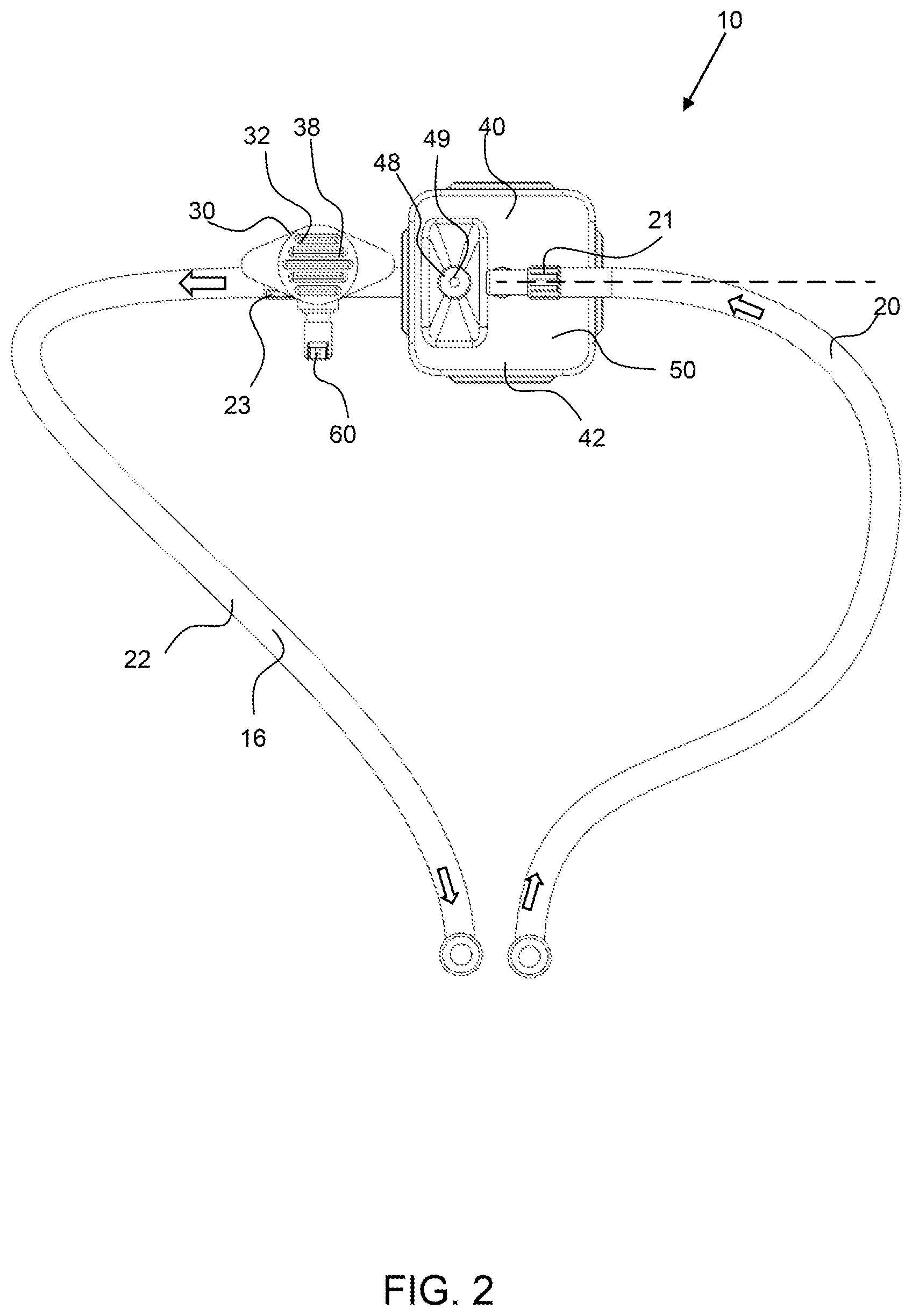 Patent US12311093 Figure 2 – Manual clot aspiration and filtration system and method of removing a clot