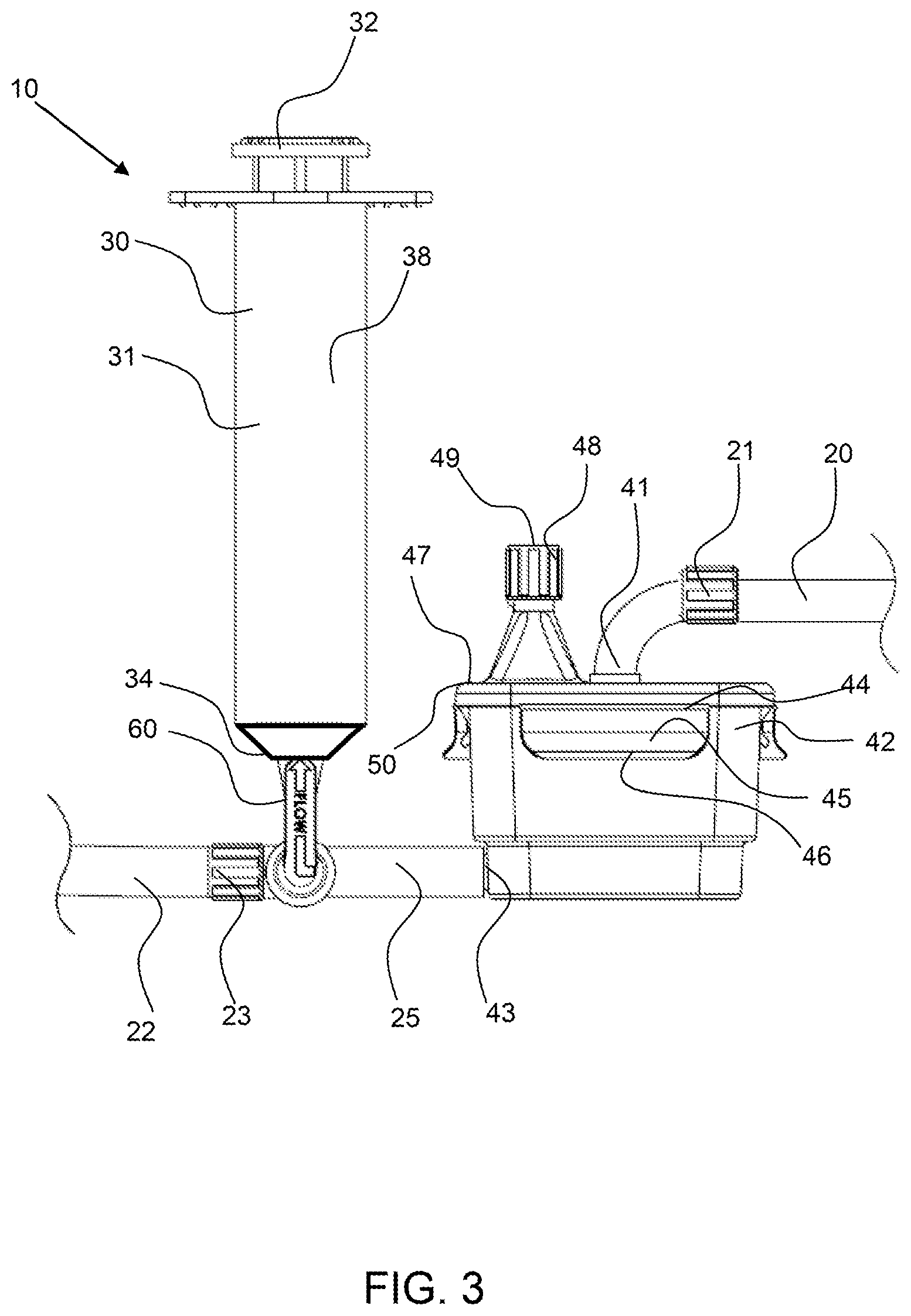 Patent US12311093 Figure 3 – Manual clot aspiration and filtration system and method of removing a clot