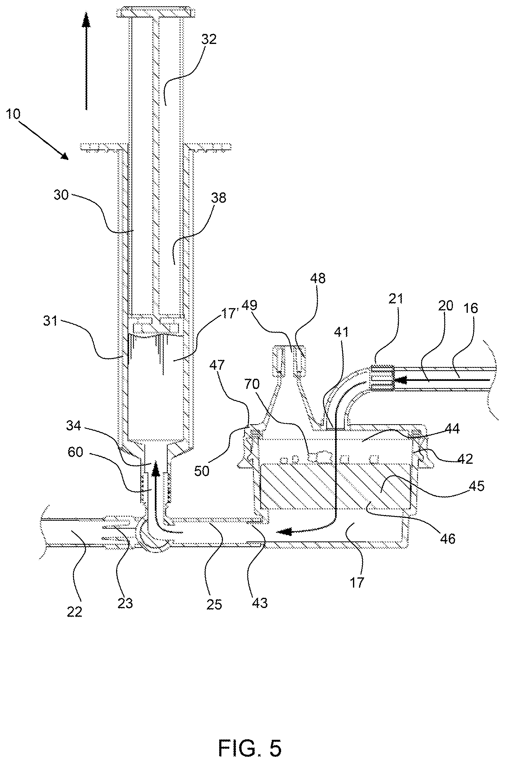 Patent US12311093 Figure 5 – Manual clot aspiration and filtration system and method of removing a clot