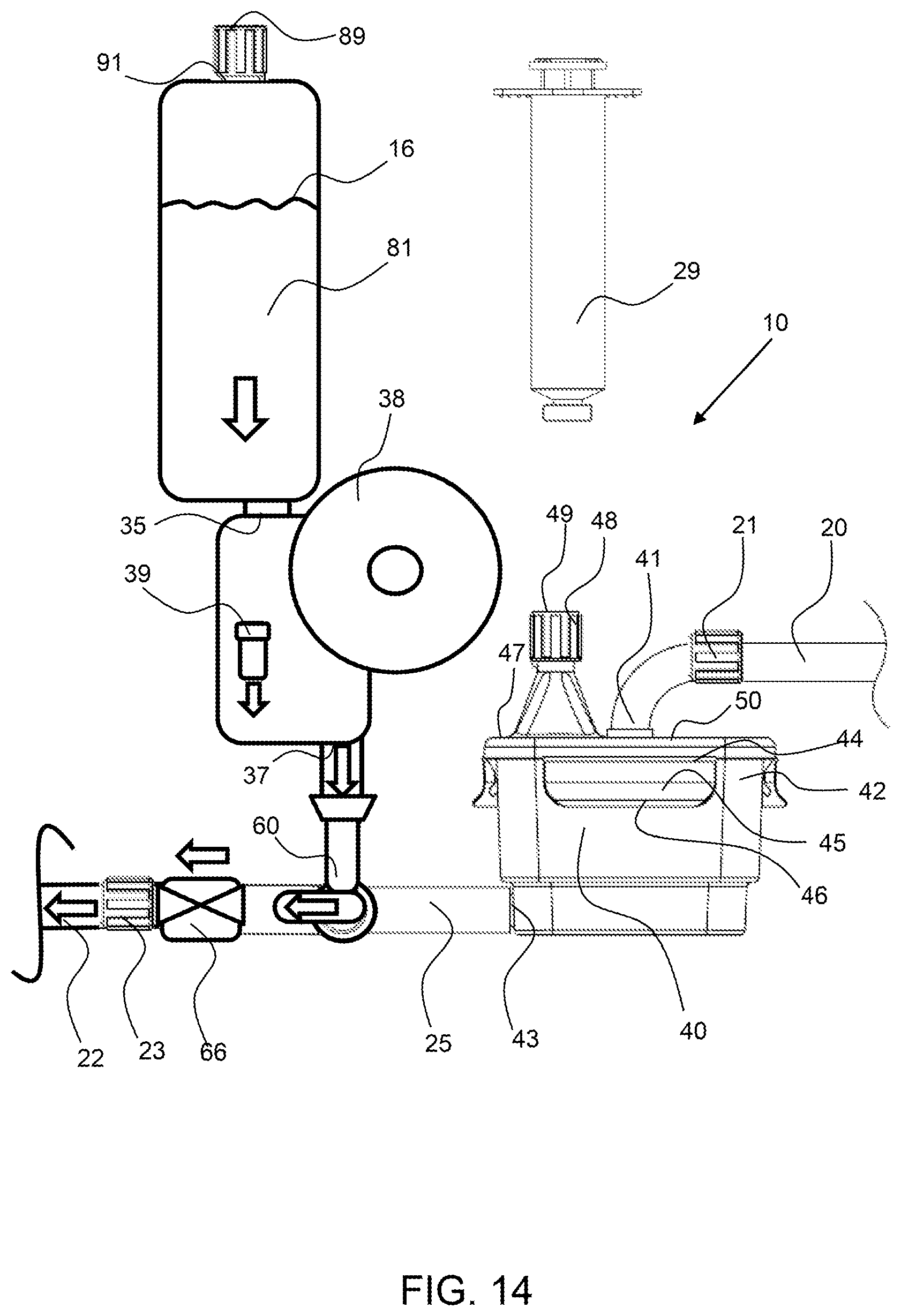 Patent US12311093 Figure 13 – Manual clot aspiration and filtration system and method of removing a clot