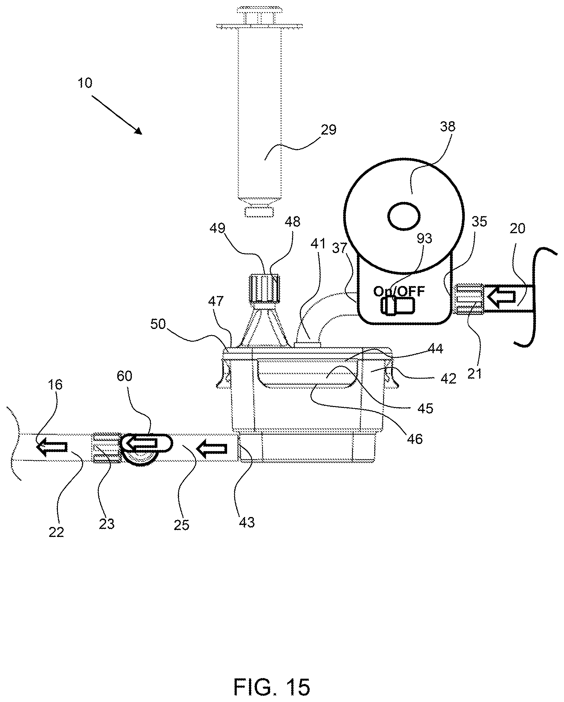 Patent US12311093 Figure 14 – Manual clot aspiration and filtration system and method of removing a clot