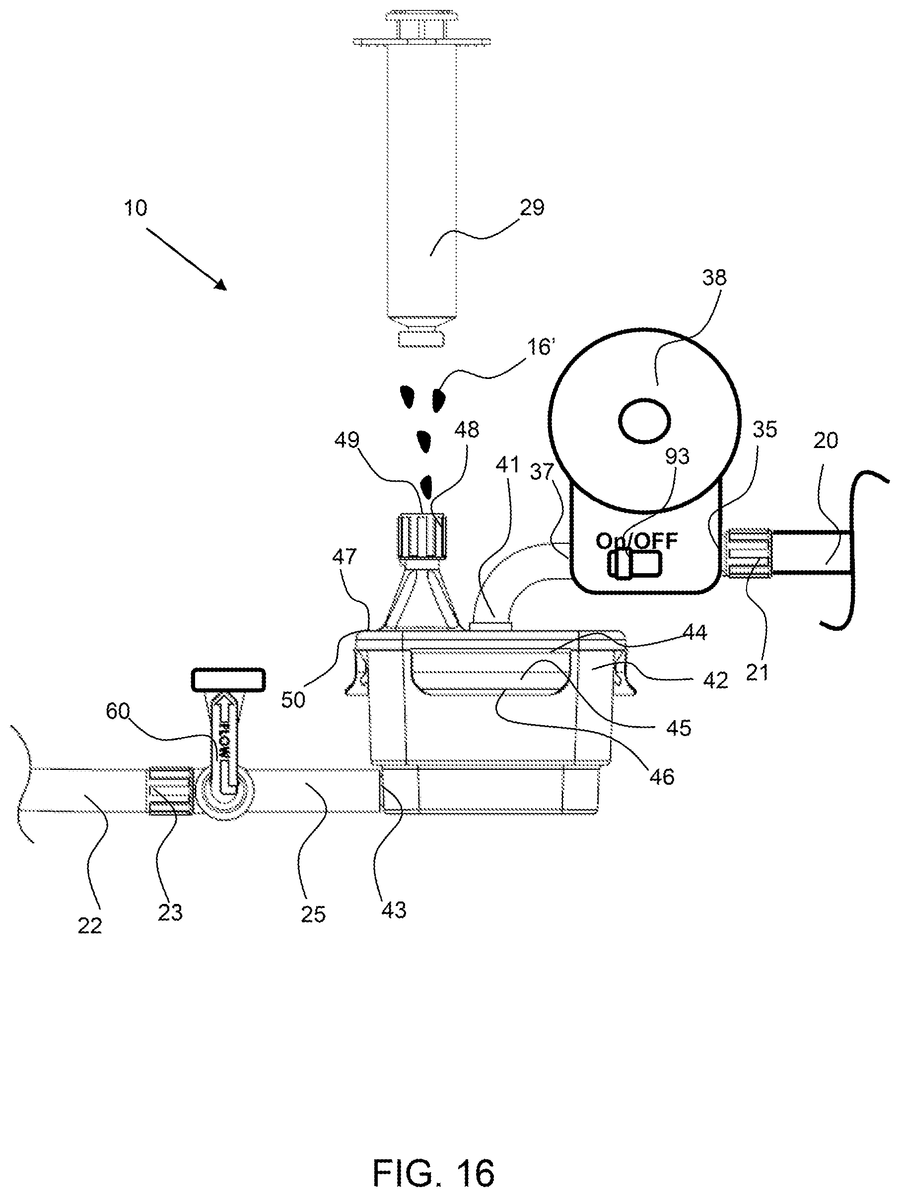 Patent US12311093 Figure 15 – Manual clot aspiration and filtration system and method of removing a clot