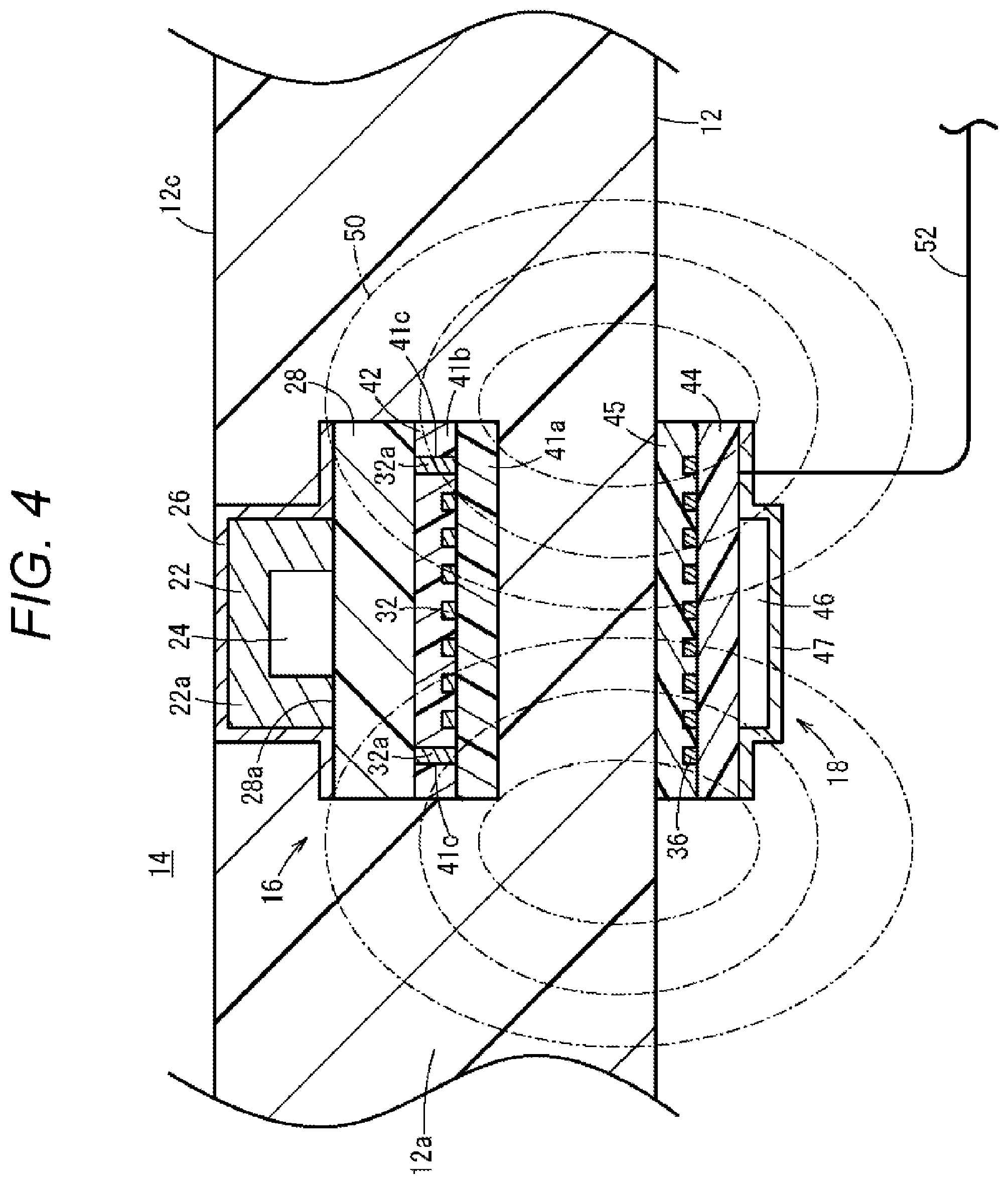 Patent US12311094 Figure 4 – Sensor system and medical device