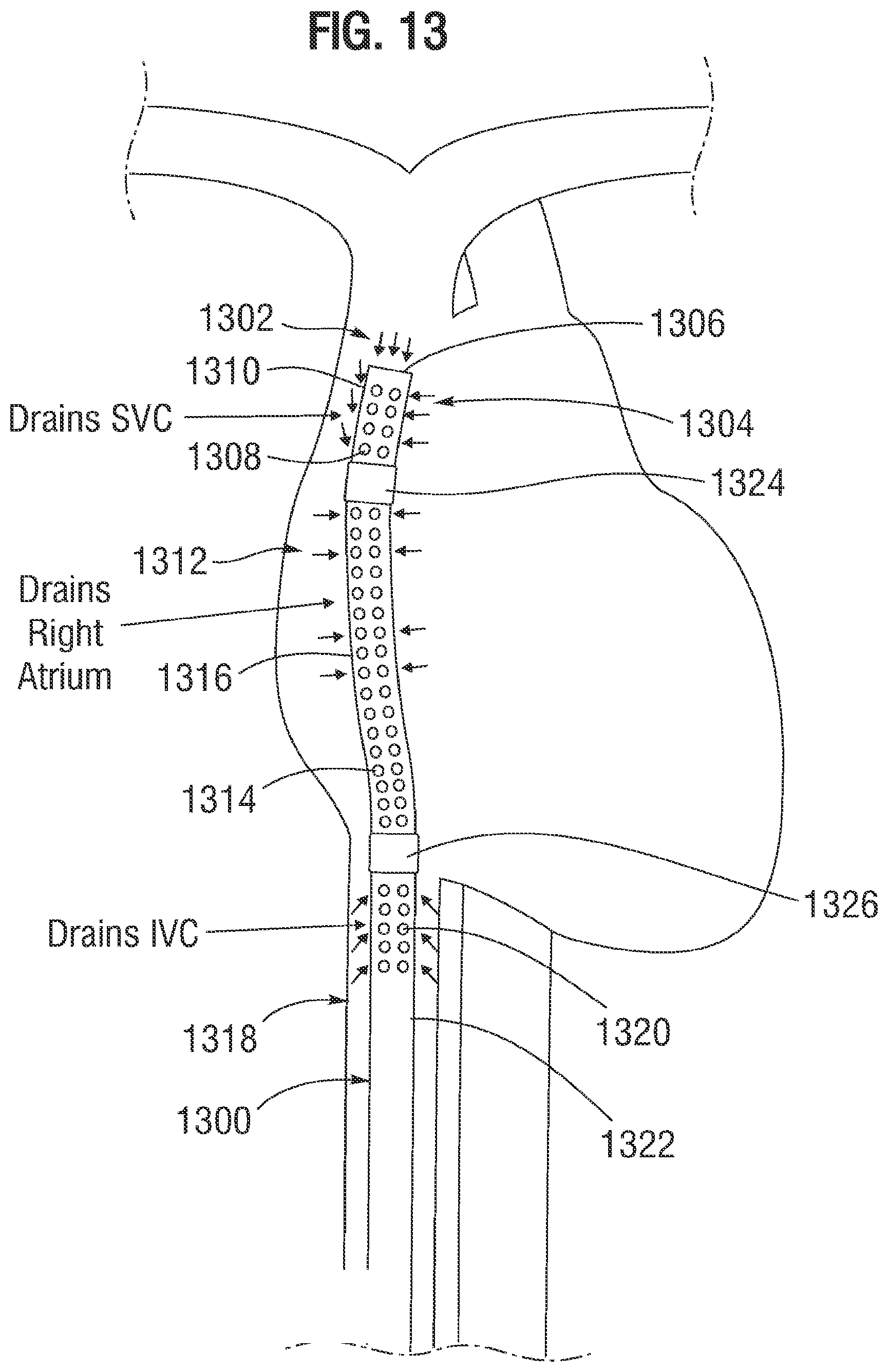 Patent US12311095 Figure 8 – Multi-lumen cannulae