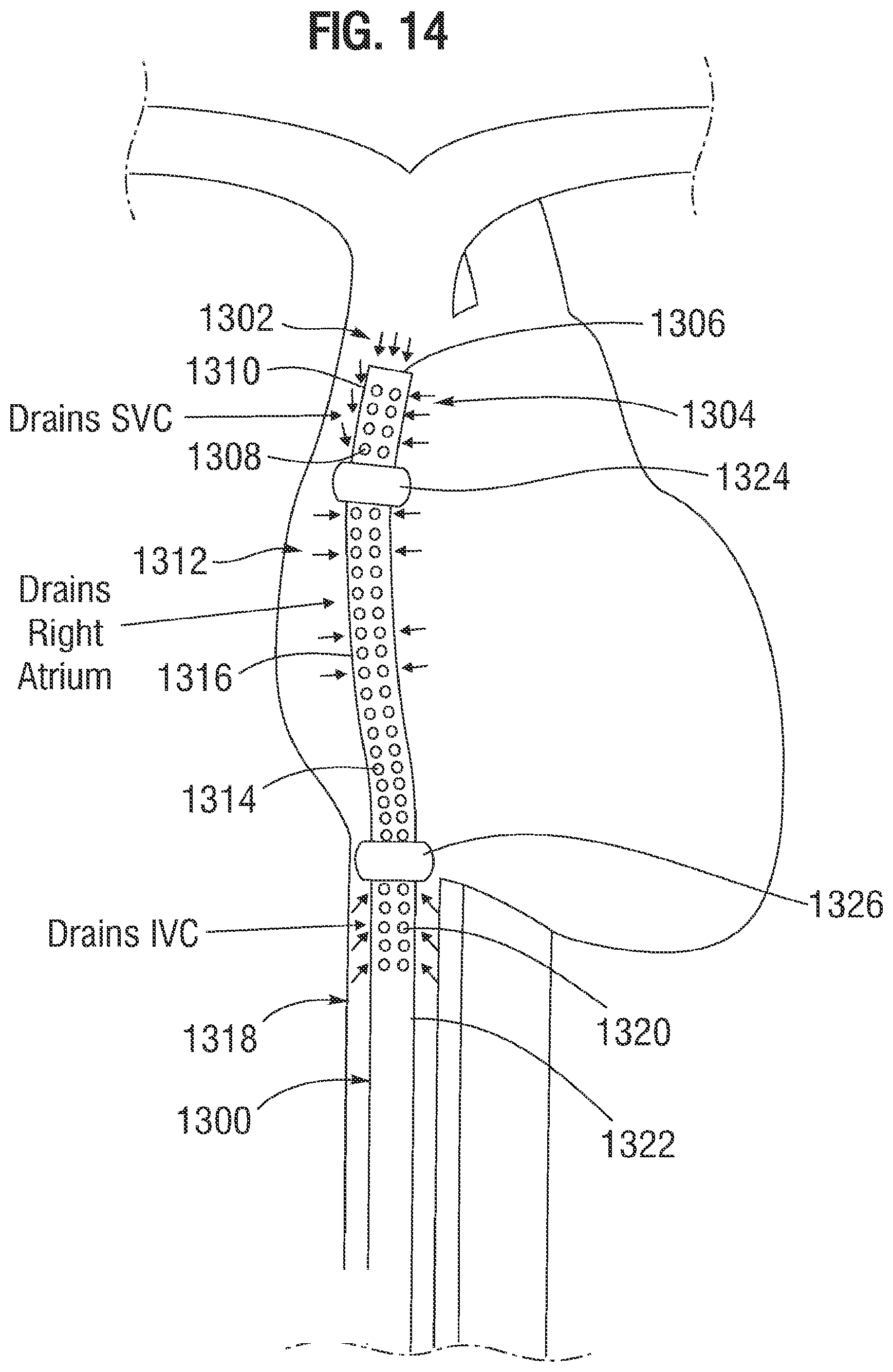 Patent US12311095 Figure 9 – Multi-lumen cannulae