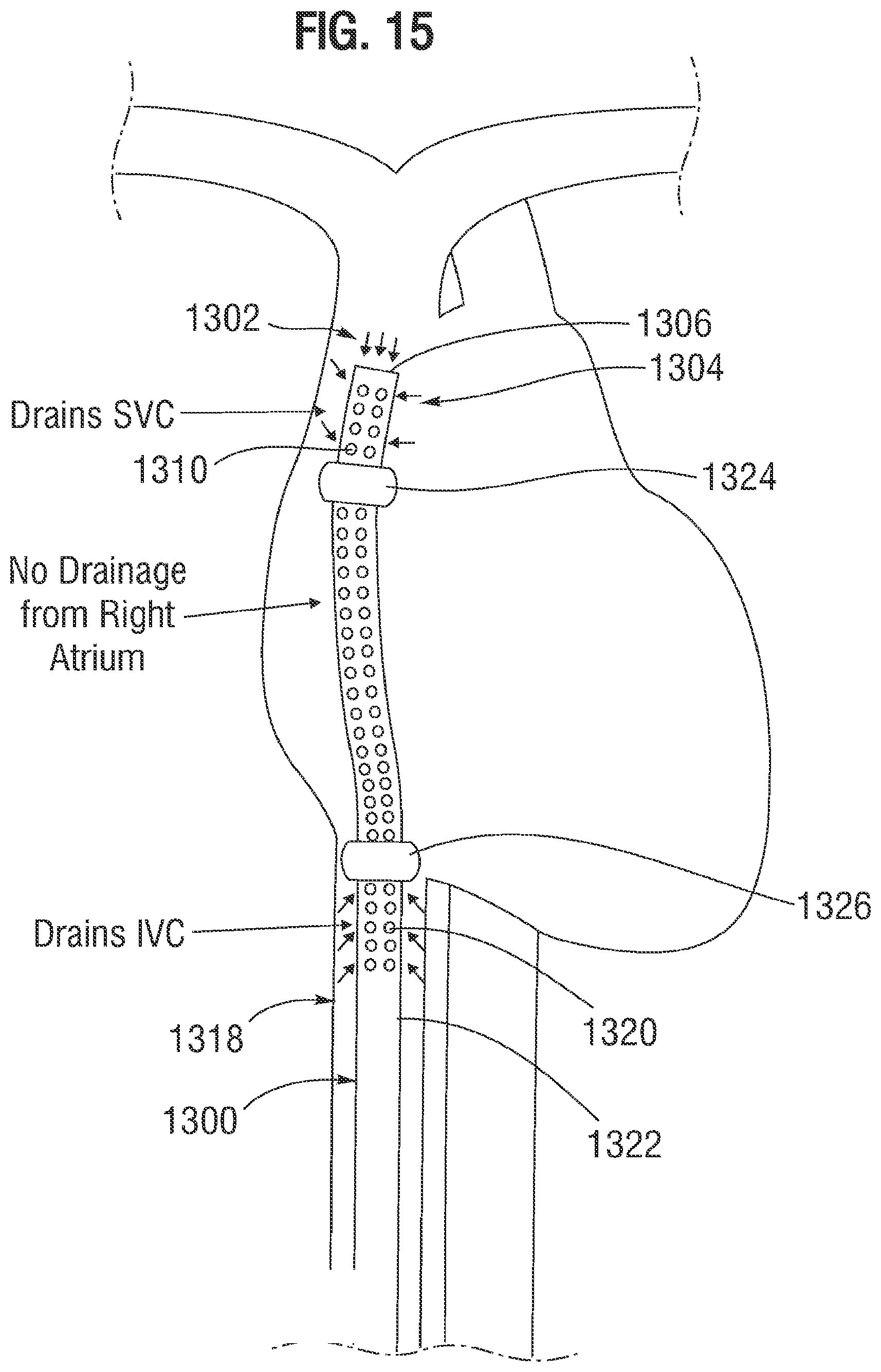 Patent US12311095 Figure 10 – Multi-lumen cannulae