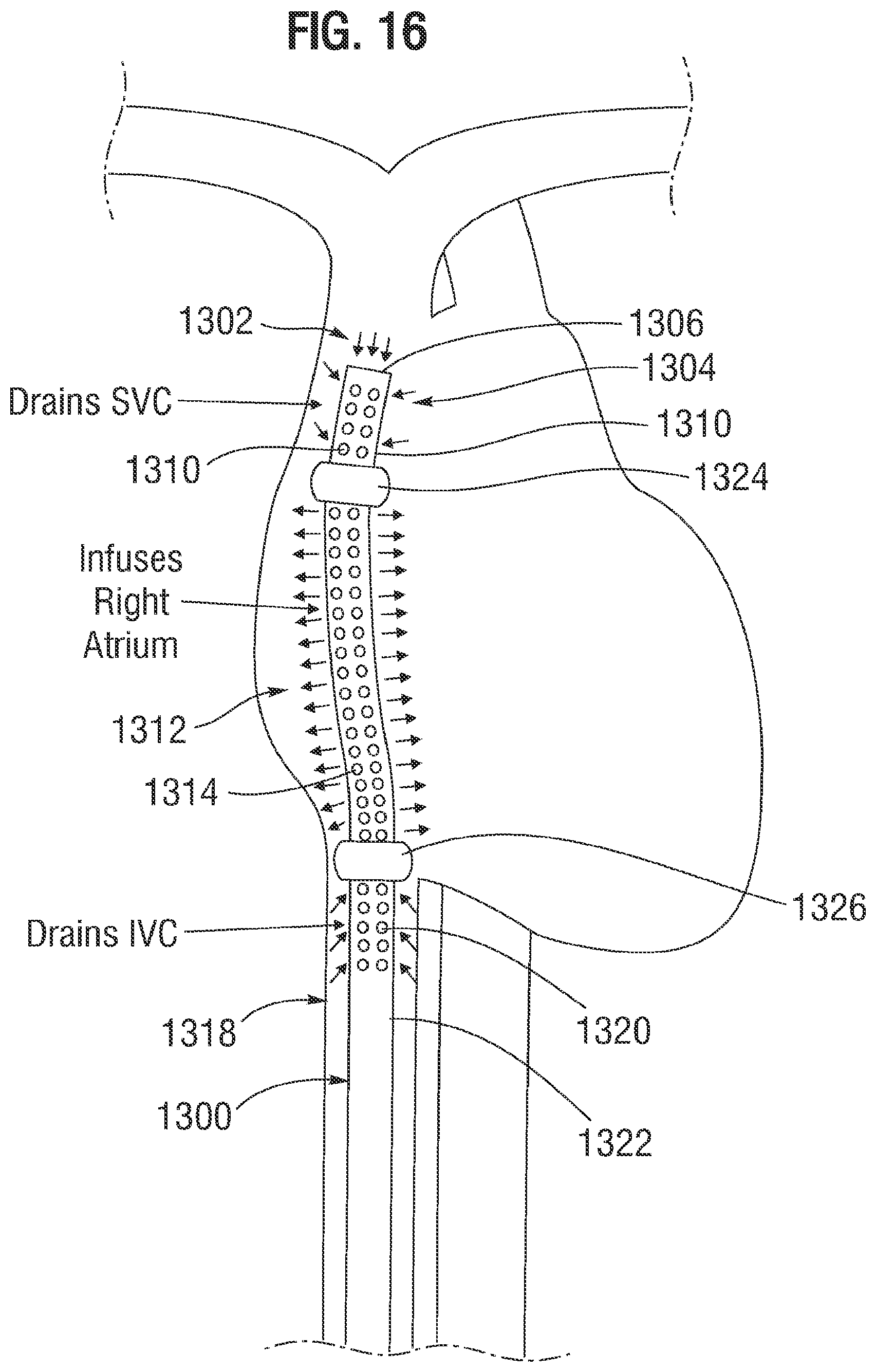 Patent US12311095 Figure 11 – Multi-lumen cannulae