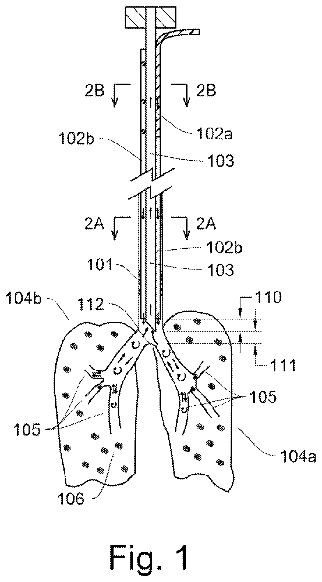 Patent US12311102 Figure 1 – Lung ventilator system and method of ventilating lungs in breathing and non-breathing patients