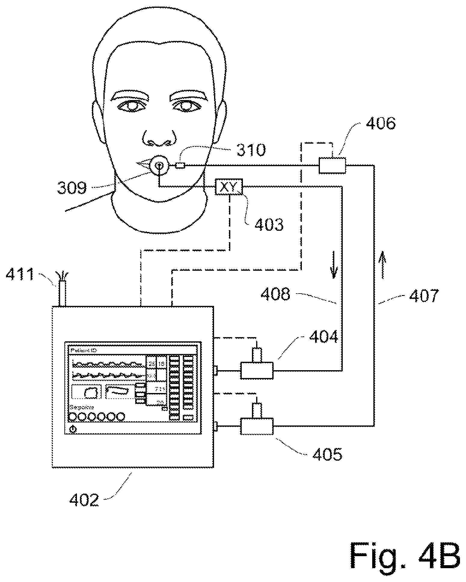 Patent US12311102 Figure 8 – Lung ventilator system and method of ventilating lungs in breathing and non-breathing patients