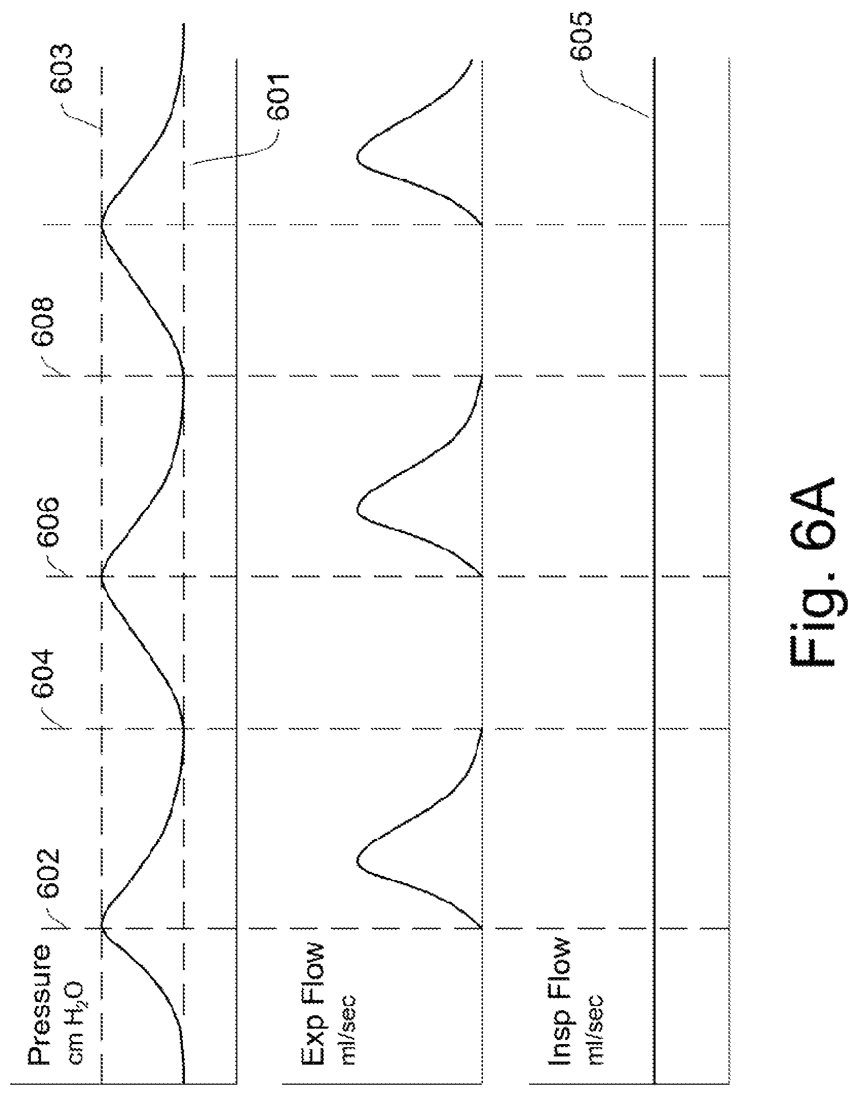 Patent US12311102 Figure 10 – Lung ventilator system and method of ventilating lungs in breathing and non-breathing patients