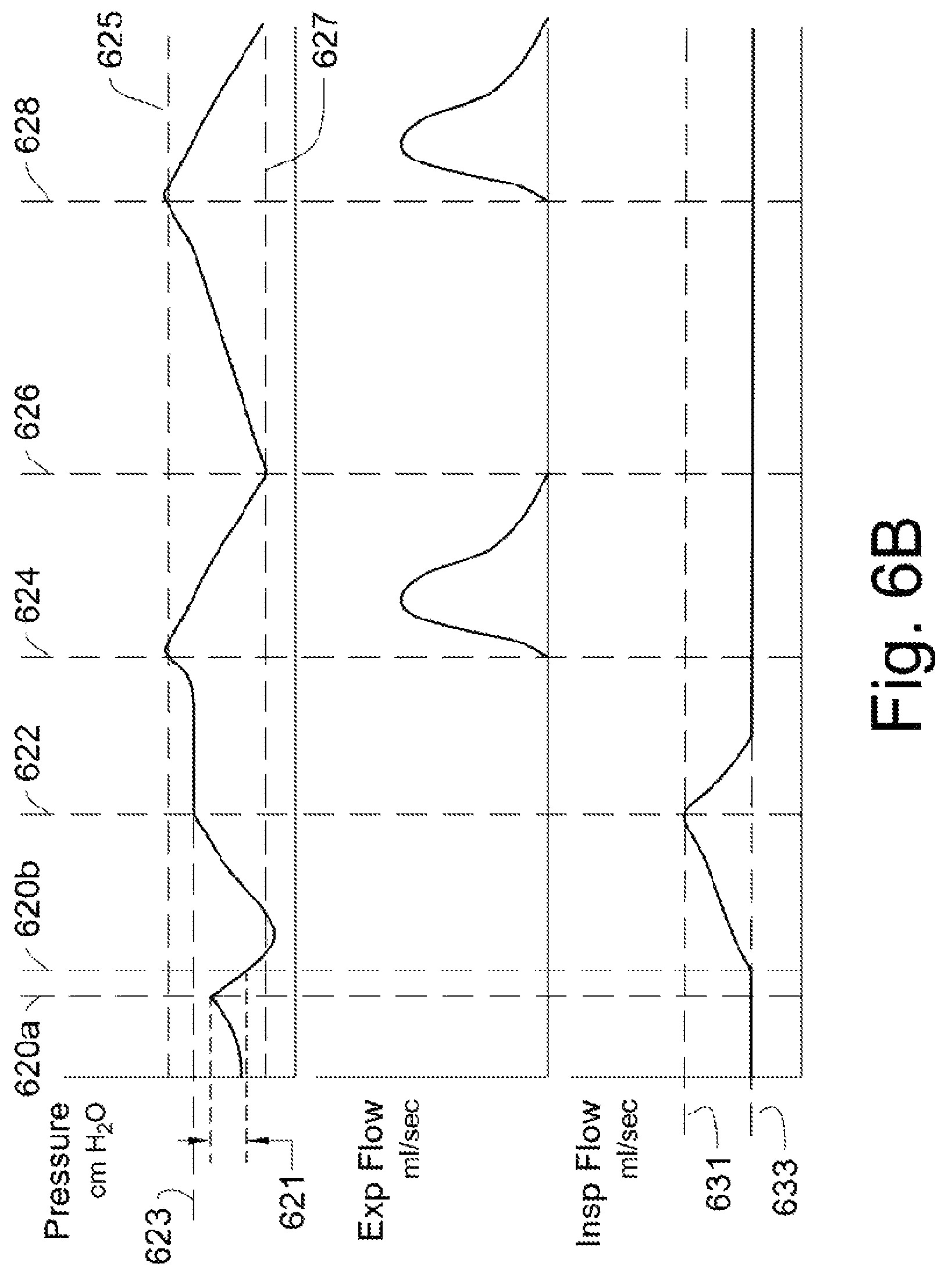 Patent US12311102 Figure 11 – Lung ventilator system and method of ventilating lungs in breathing and non-breathing patients