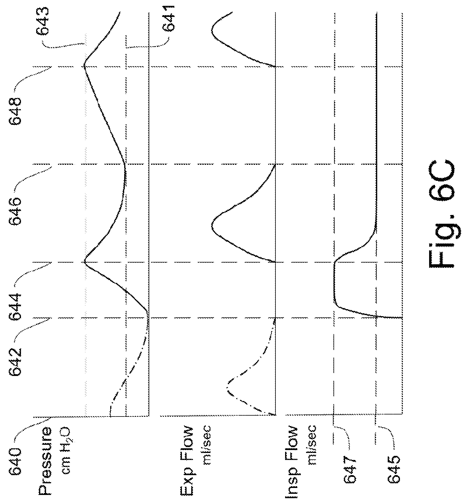 Patent US12311102 Figure 12 – Lung ventilator system and method of ventilating lungs in breathing and non-breathing patients