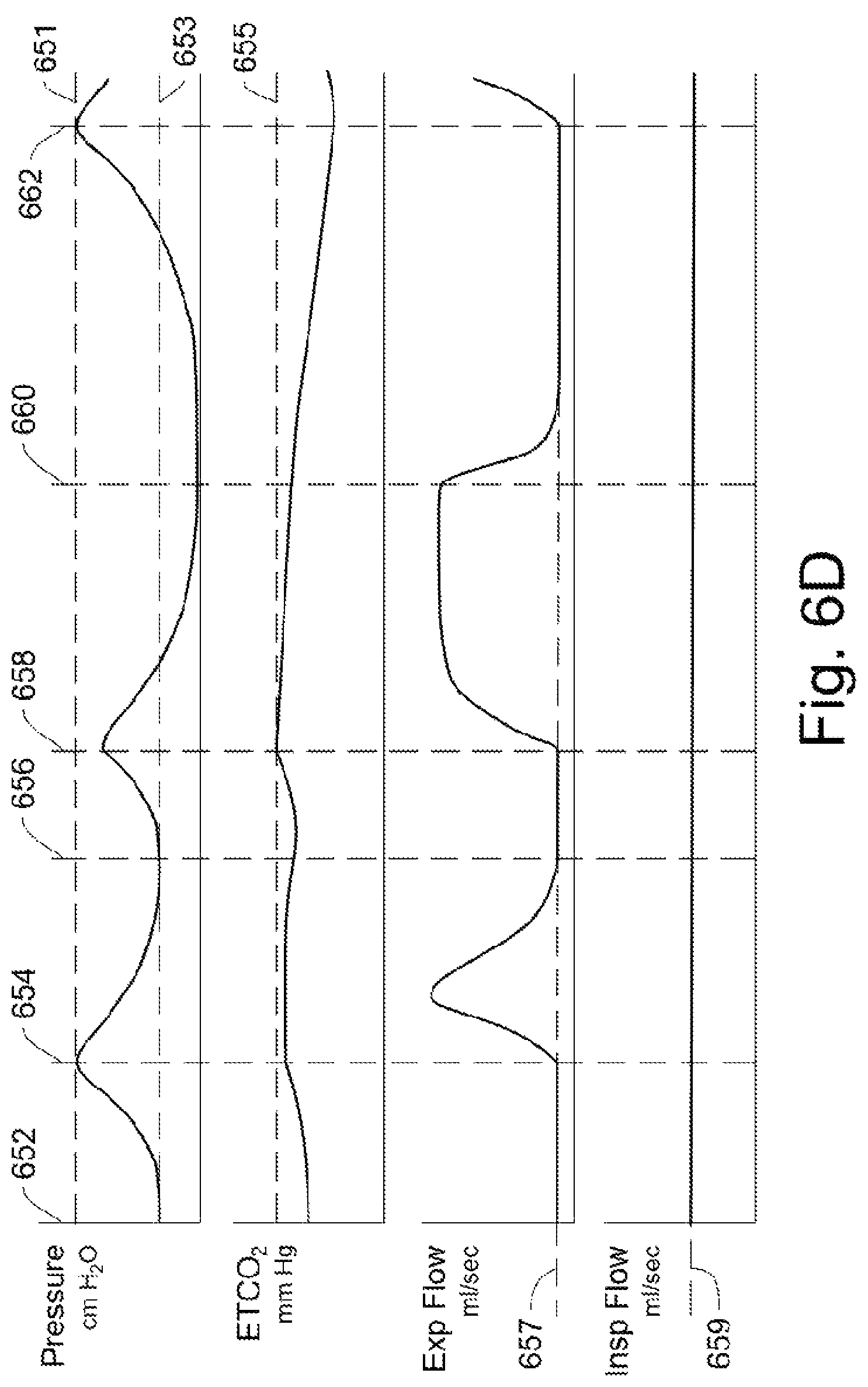 Patent US12311102 Figure 13 – Lung ventilator system and method of ventilating lungs in breathing and non-breathing patients