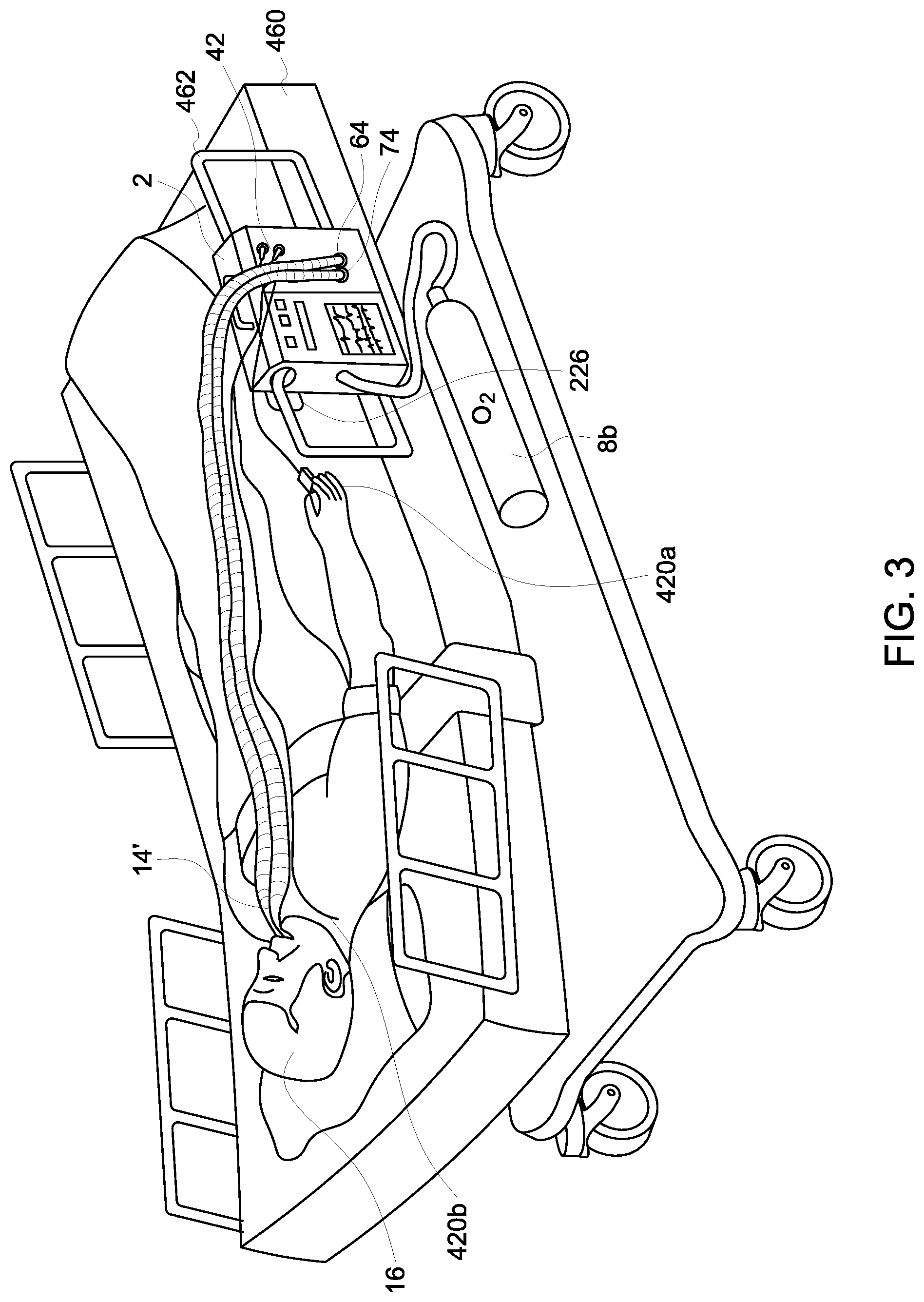 Patent US12311104 Figure 4 – Ventilator systems and methods