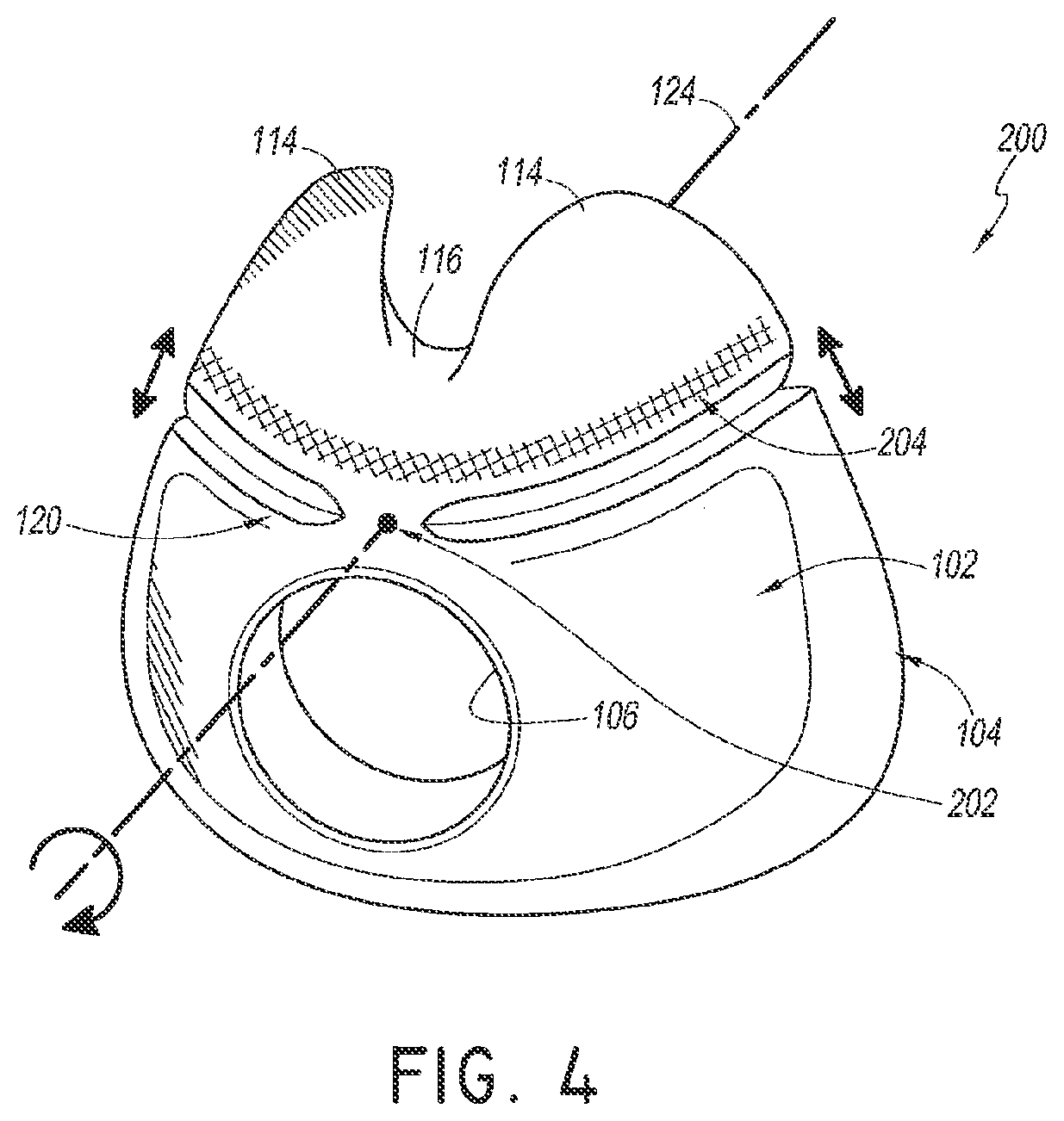 Patent US12311107 Figure 2 – Seal for a patient interface, interface assemblies and aspects thereof