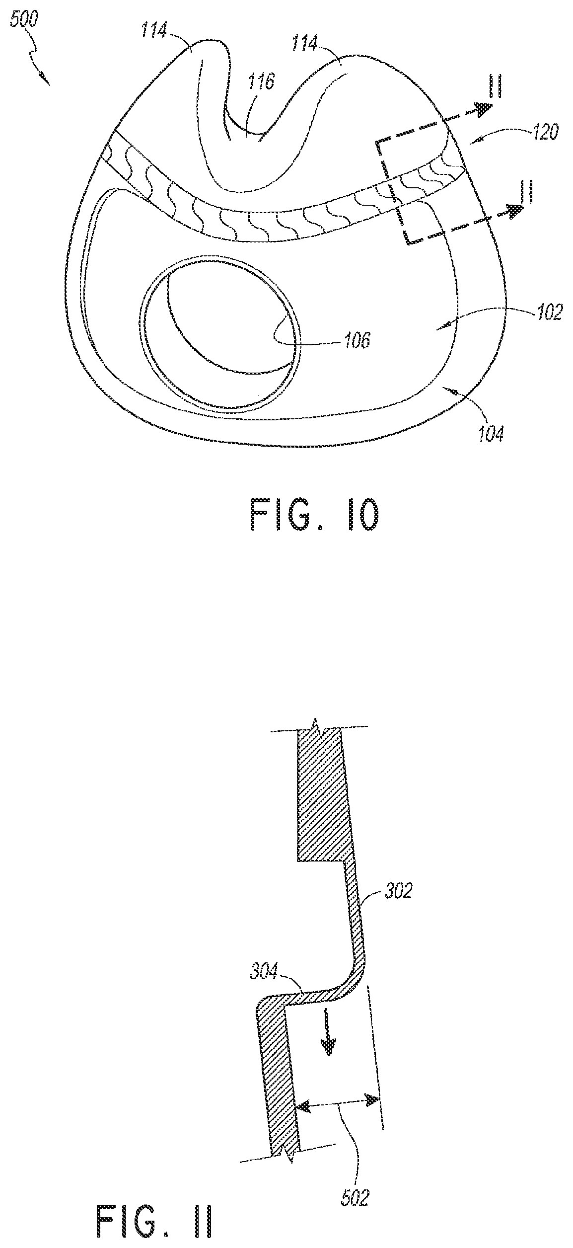 Patent US12311107 Figure 5 – Seal for a patient interface, interface assemblies and aspects thereof