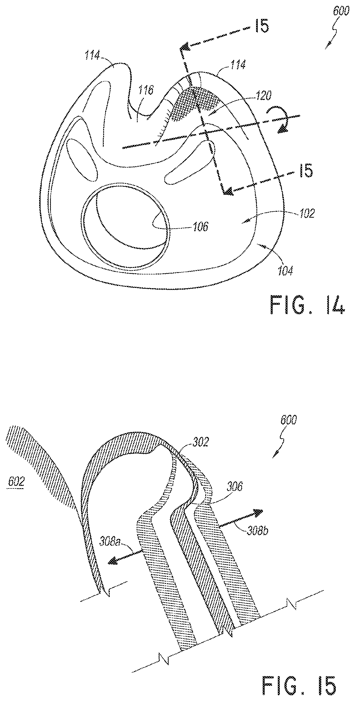 Patent US12311107 Figure 7 – Seal for a patient interface, interface assemblies and aspects thereof