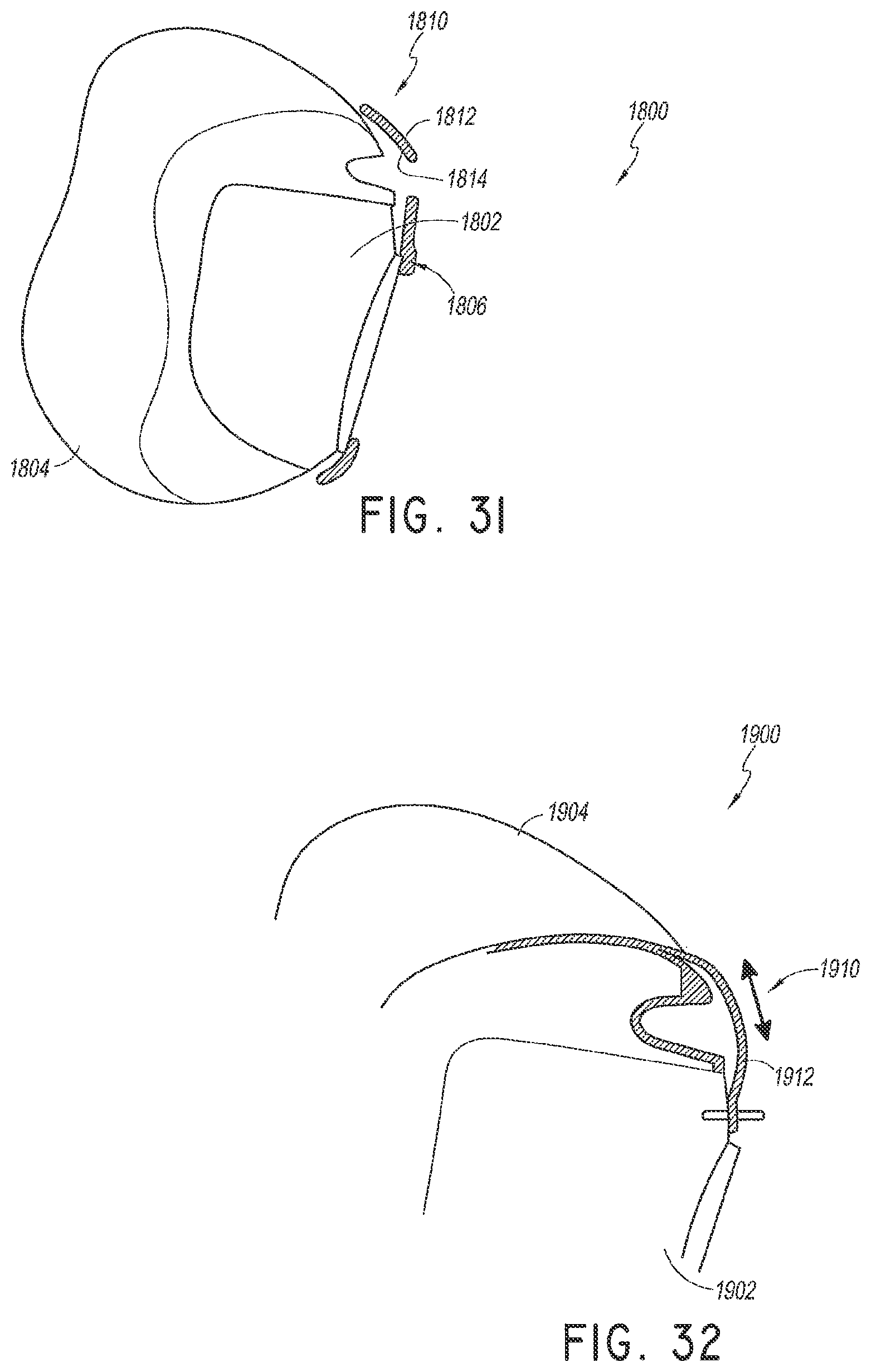 Patent US12311107 Figure 15 – Seal for a patient interface, interface assemblies and aspects thereof