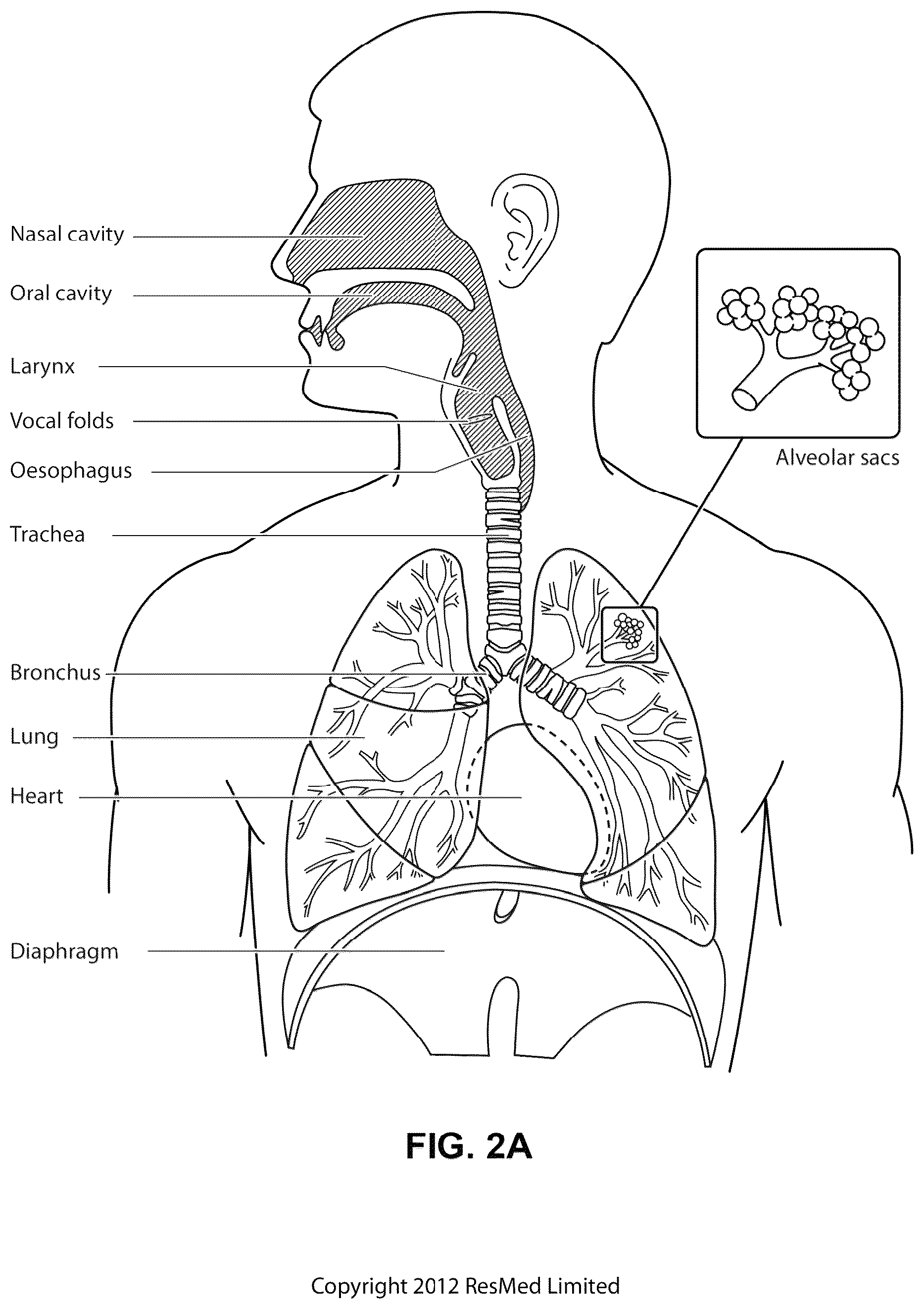Patent US12311108 Figure 4 – Conduit headgear connector for patient interface