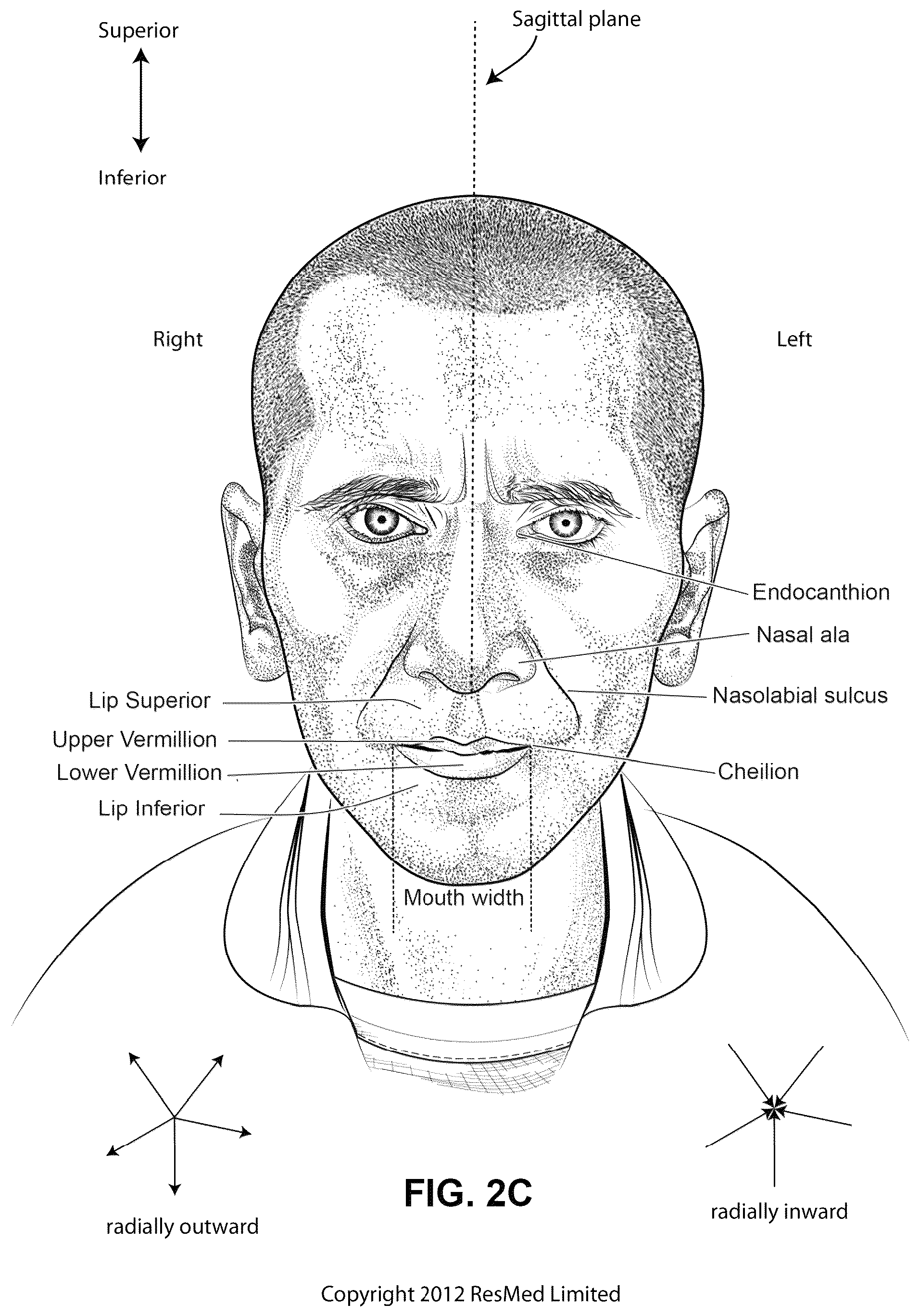 Patent US12311108 Figure 6 – Conduit headgear connector for patient interface