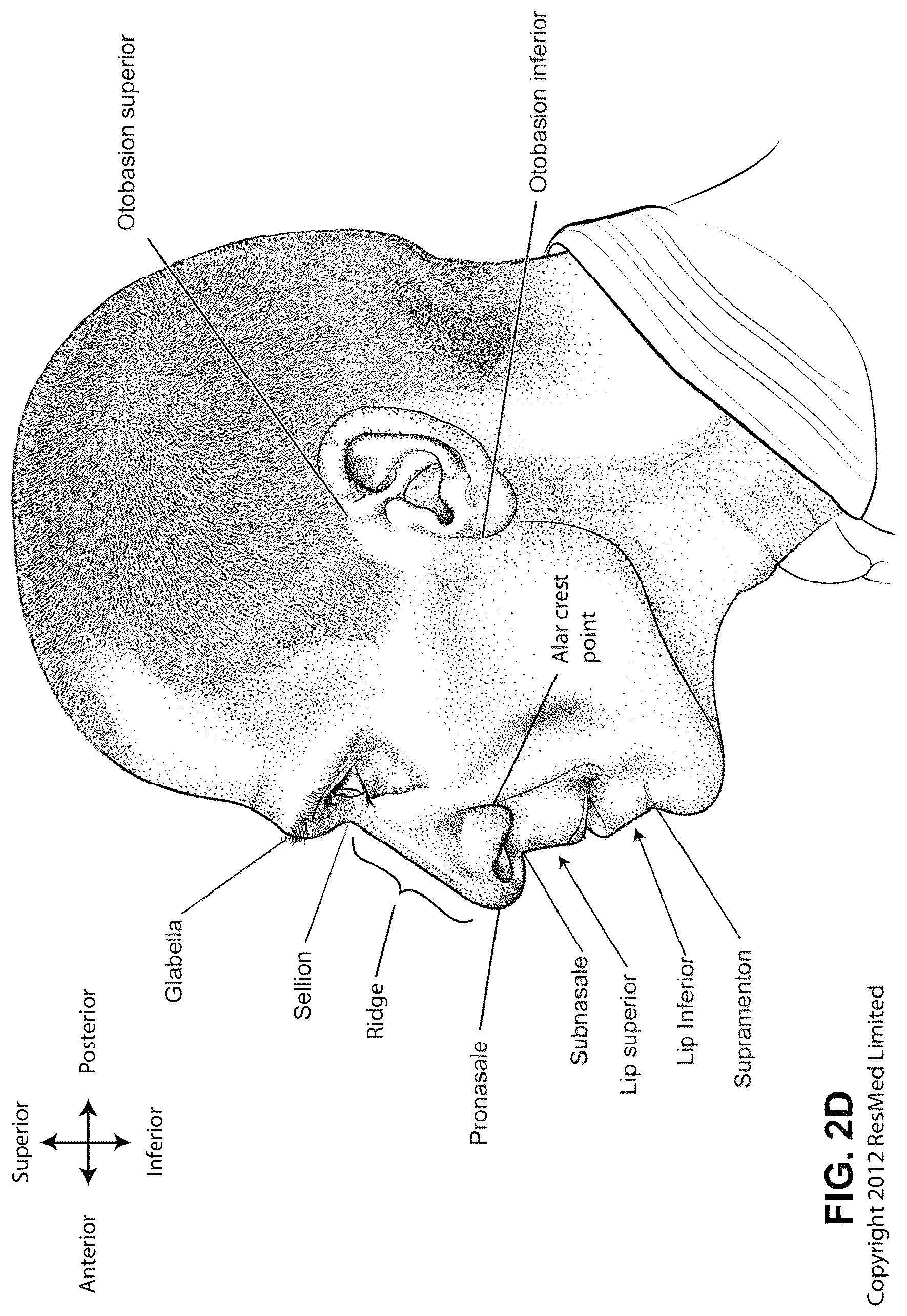 Patent US12311108 Figure 7 – Conduit headgear connector for patient interface
