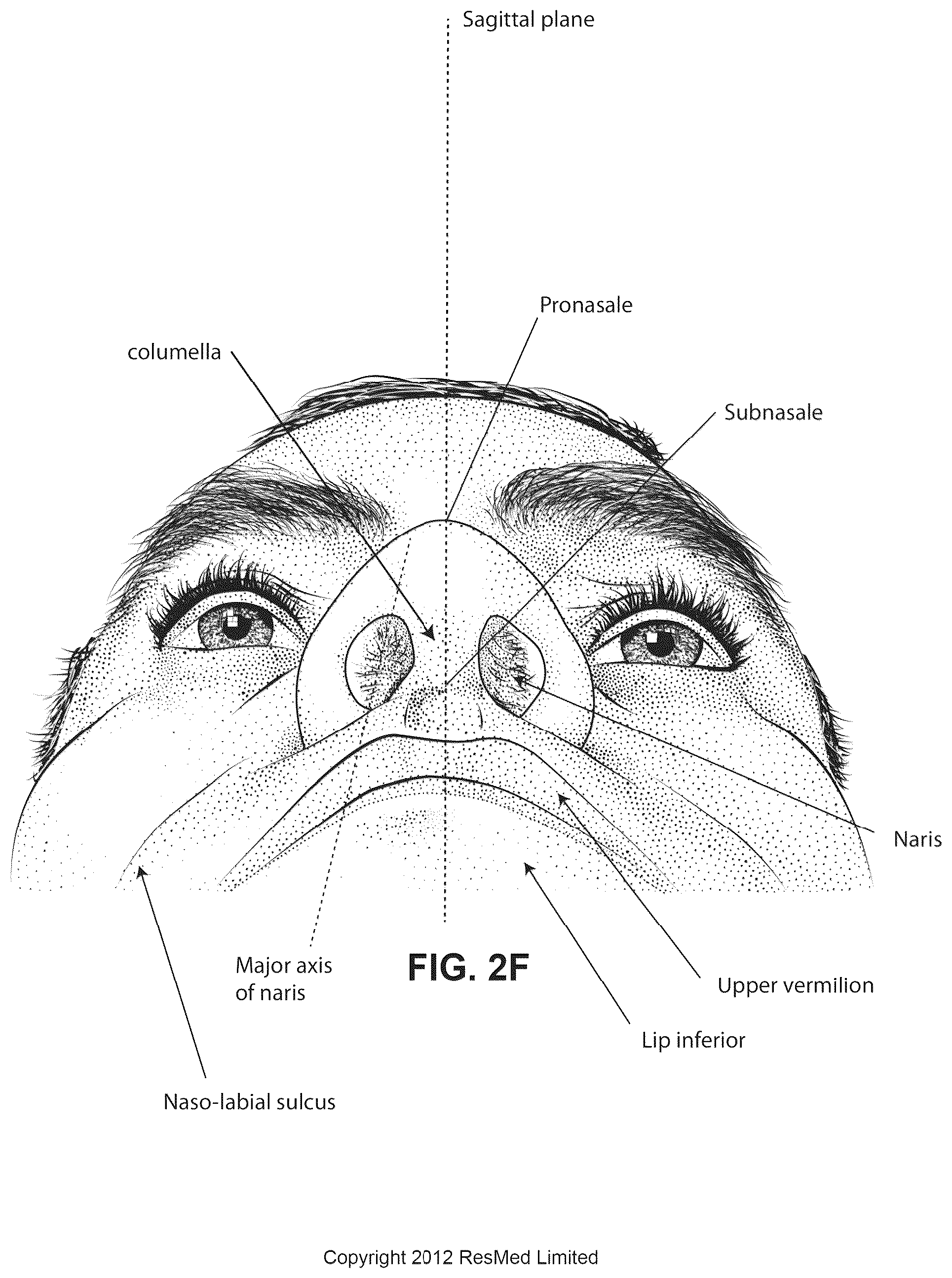 Patent US12311108 Figure 9 – Conduit headgear connector for patient interface