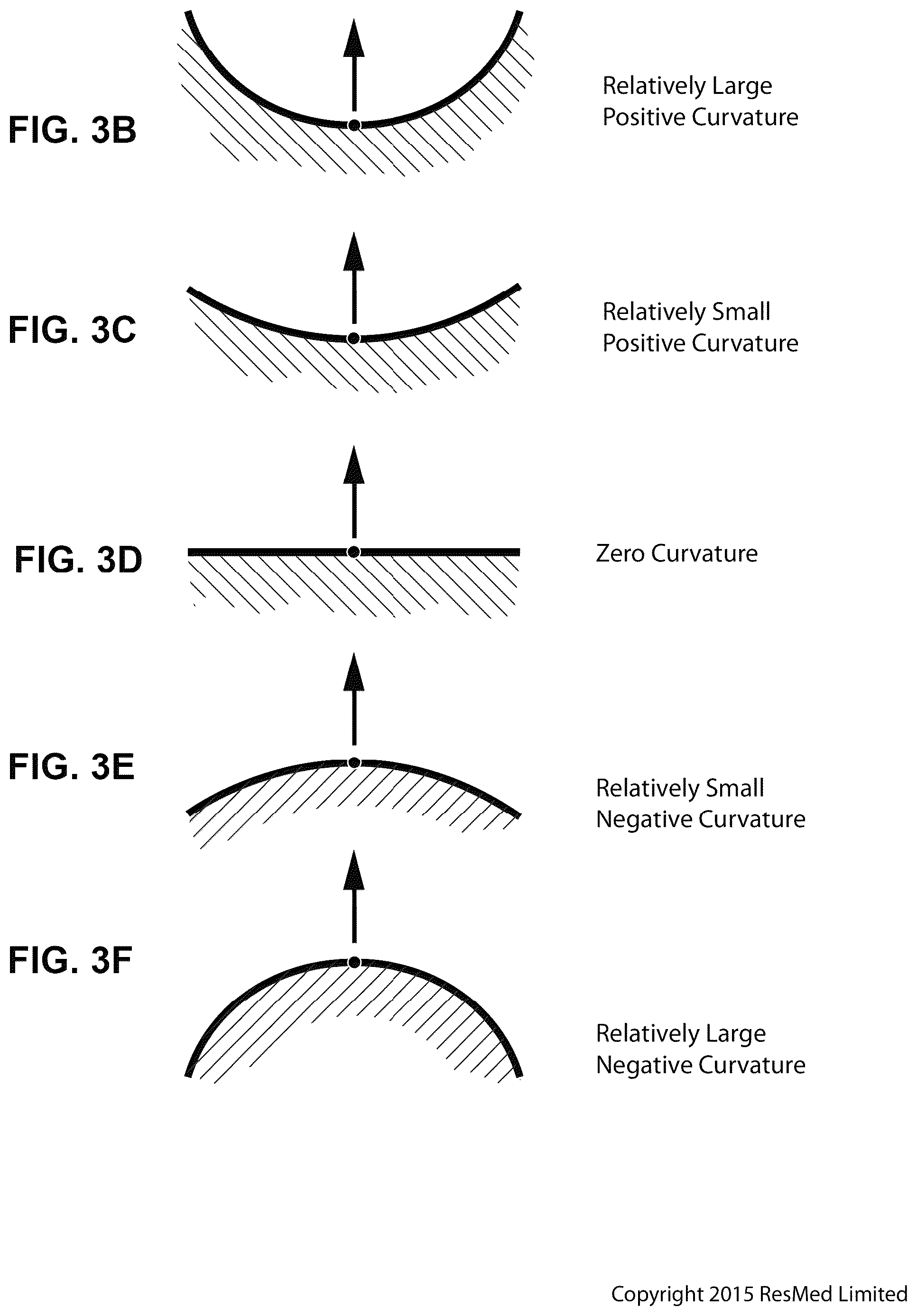 Patent US12311108 Figure 14 – Conduit headgear connector for patient interface