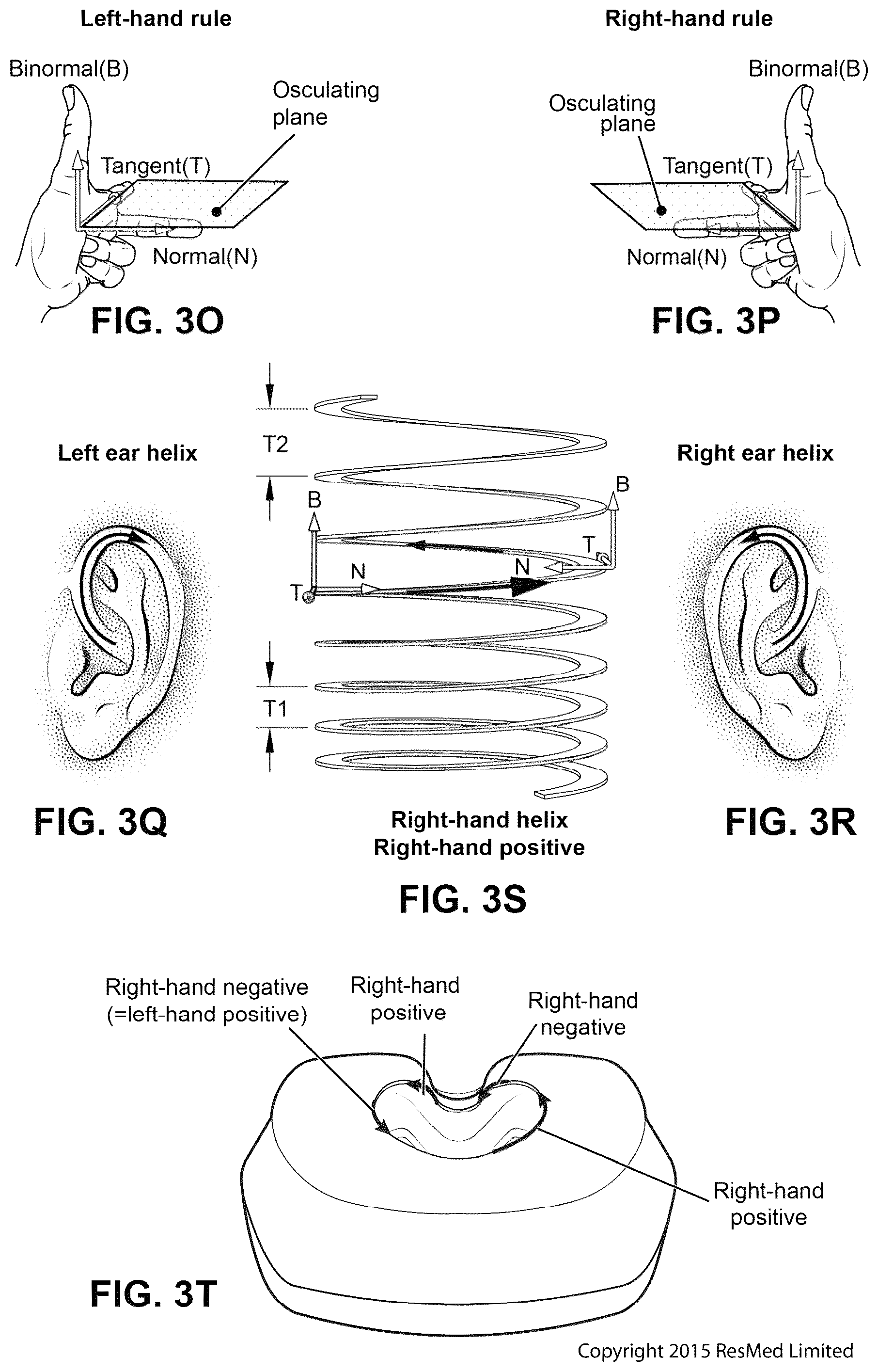 Patent US12311108 Figure 17 – Conduit headgear connector for patient interface