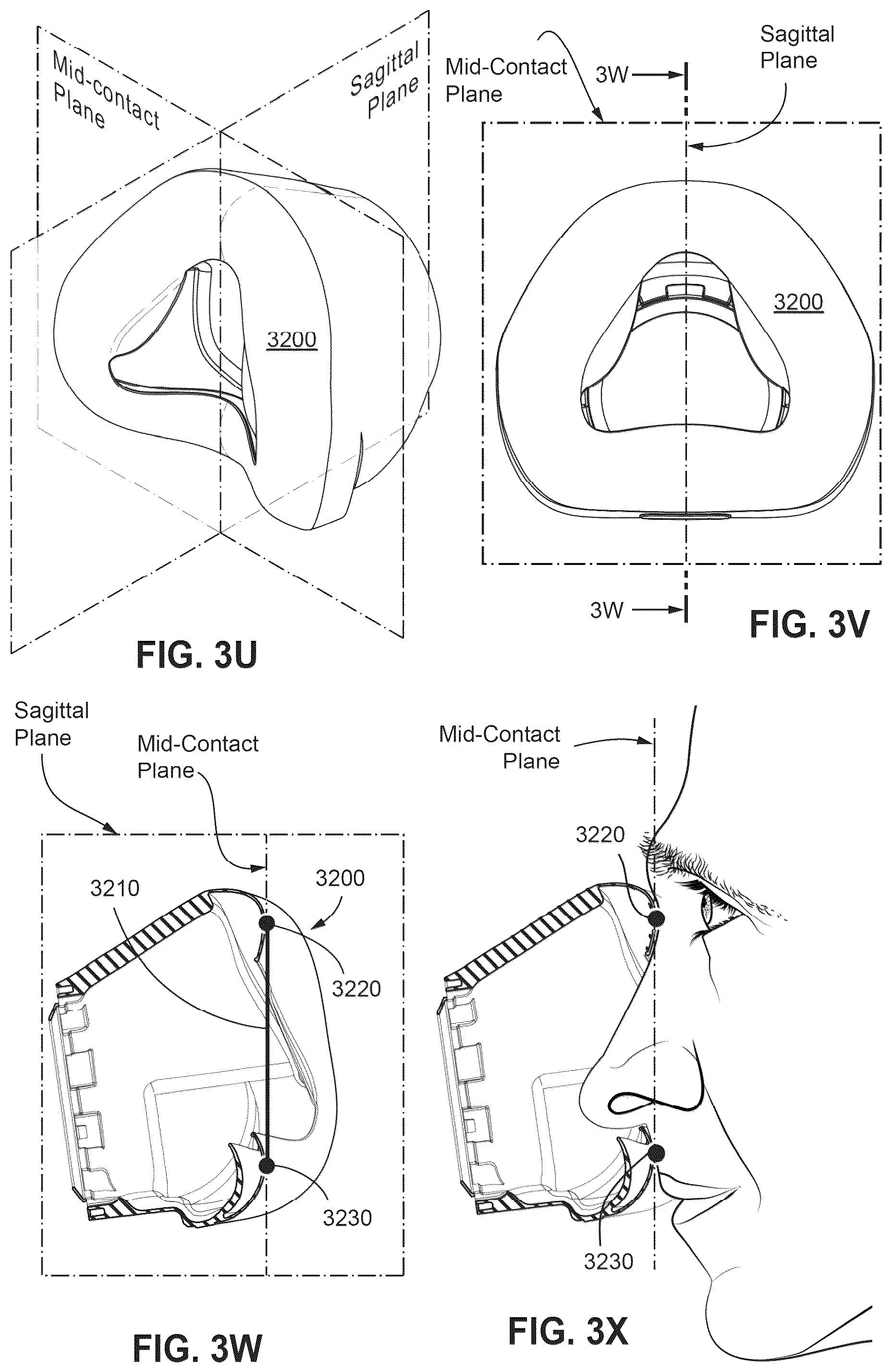 Patent US12311108 Figure 18 – Conduit headgear connector for patient interface