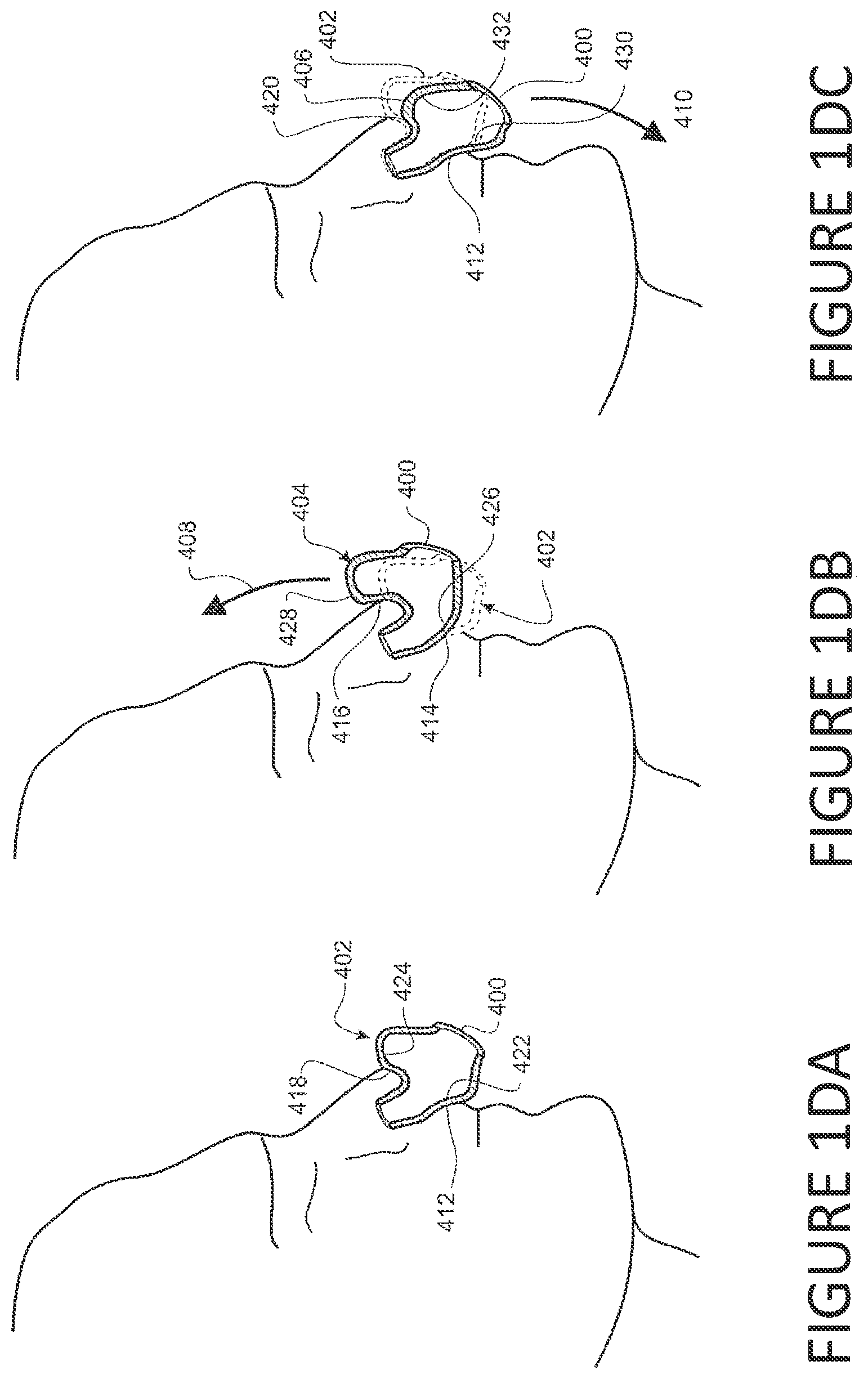 Patent US12311109 Figure 4 – Frame with supporting arms and length adjustable strap