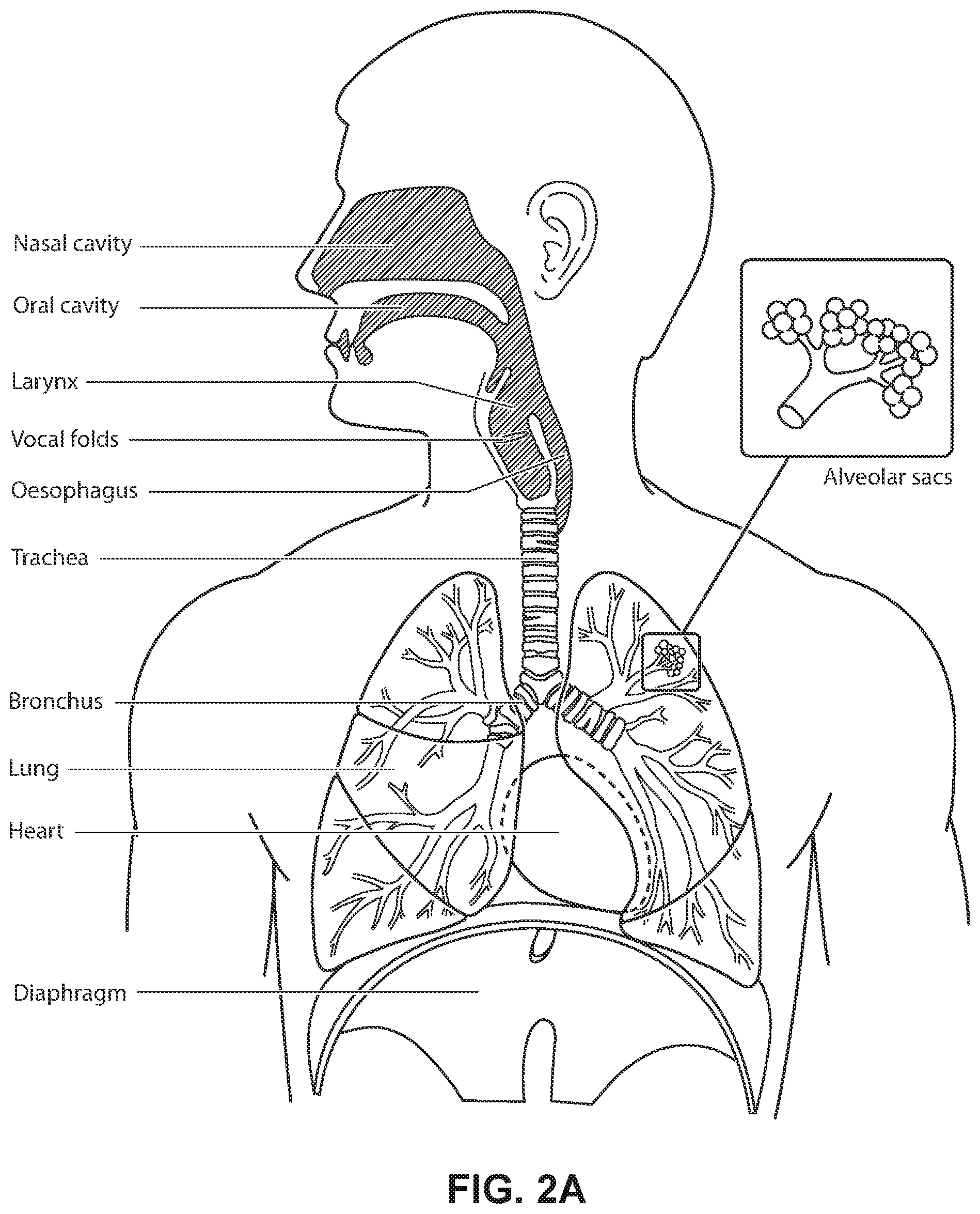 Patent US12311111 Figure 4 – Vent adaptor for a respiratory therapy system