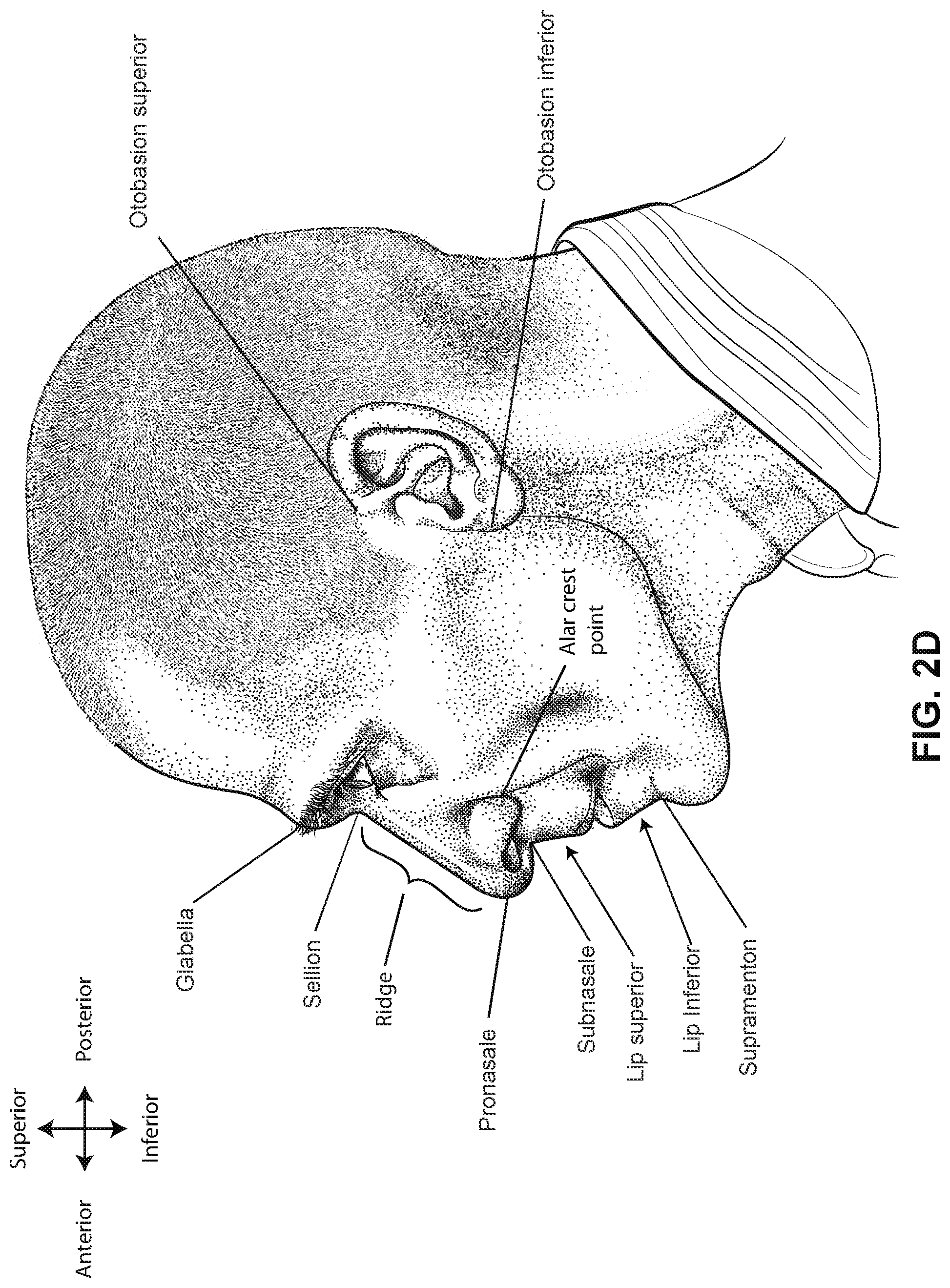 Patent US12311111 Figure 7 – Vent adaptor for a respiratory therapy system
