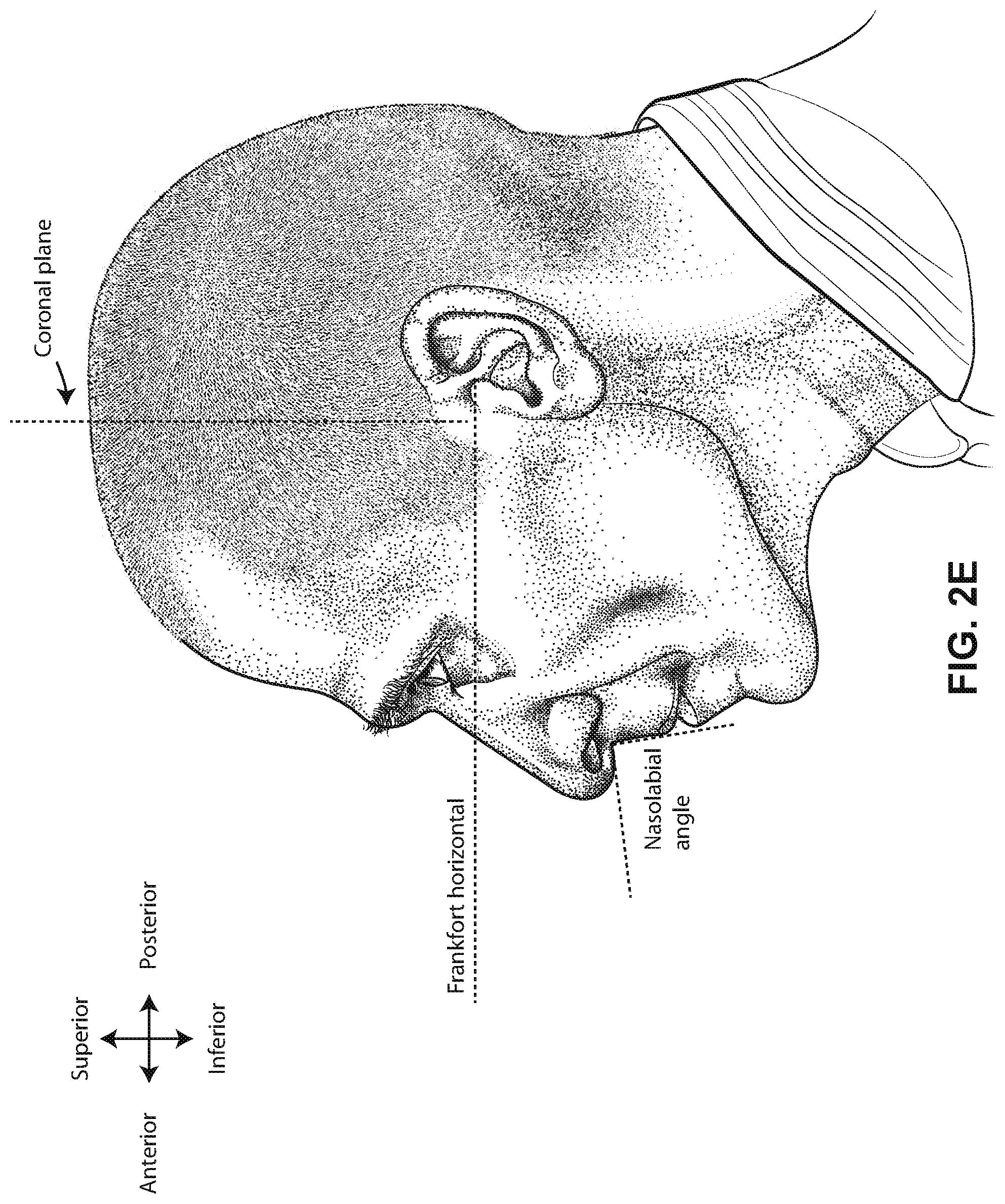 Patent US12311111 Figure 8 – Vent adaptor for a respiratory therapy system