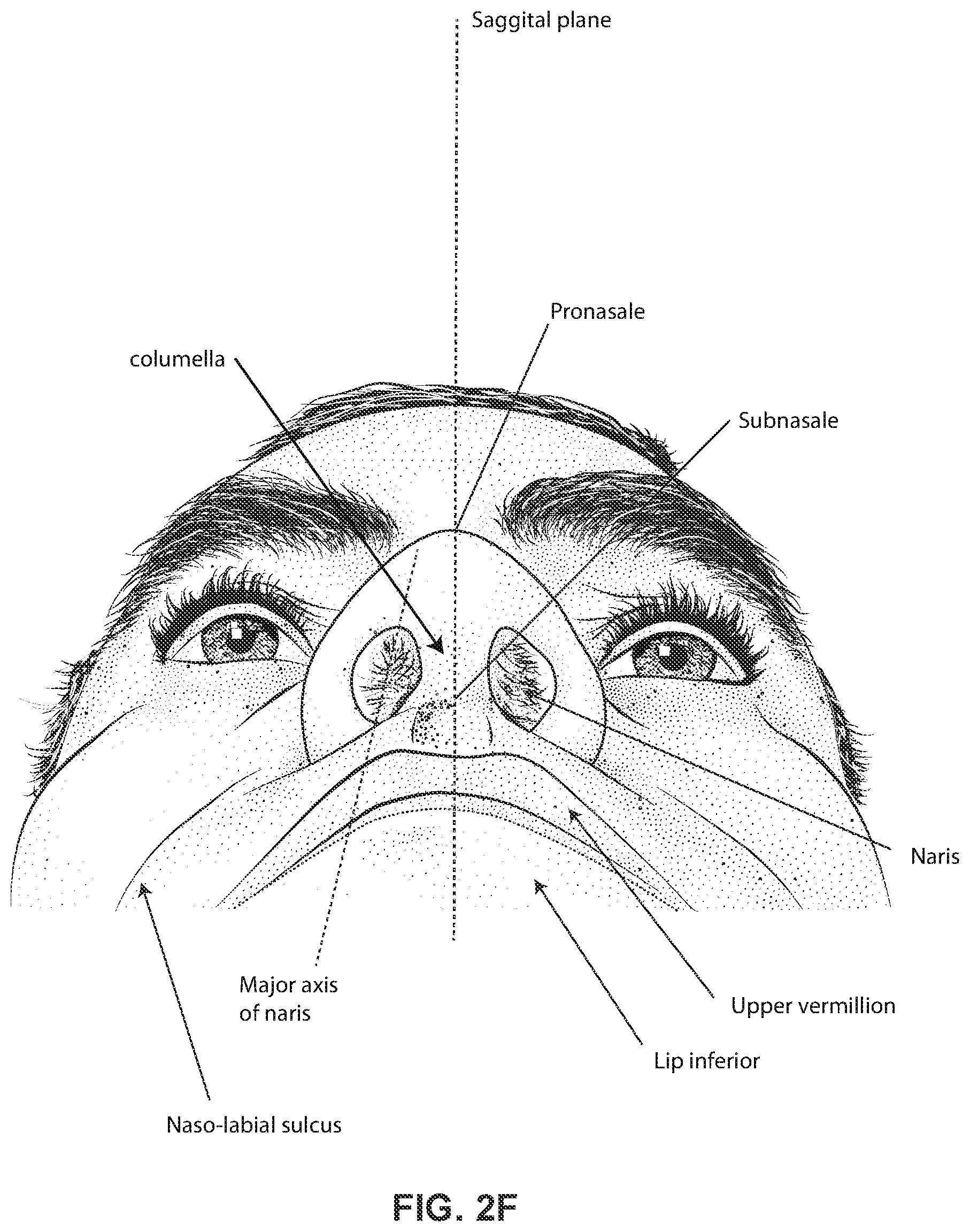 Patent US12311111 Figure 9 – Vent adaptor for a respiratory therapy system