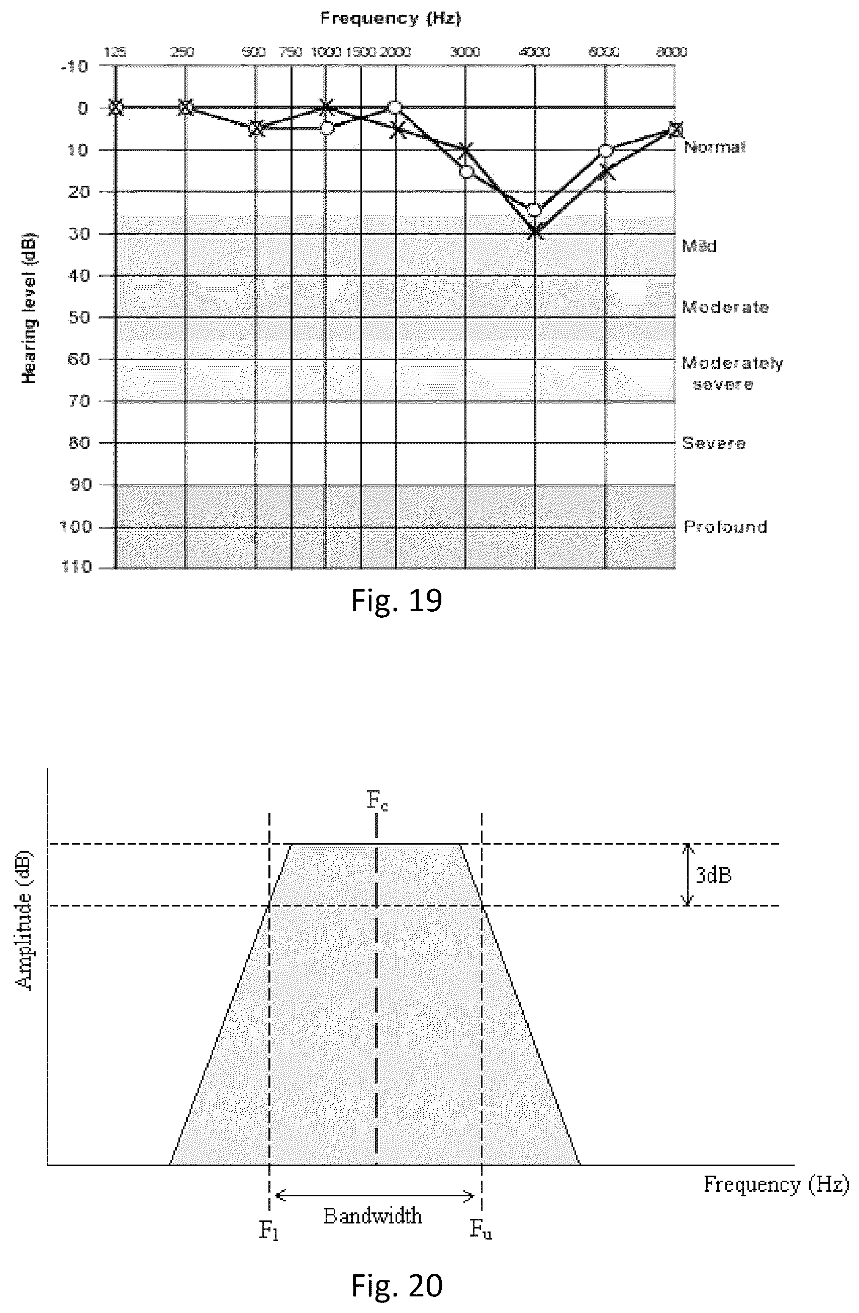Patent US12311114 Figure 12 – Method and apparatus for treating a neurological disorder