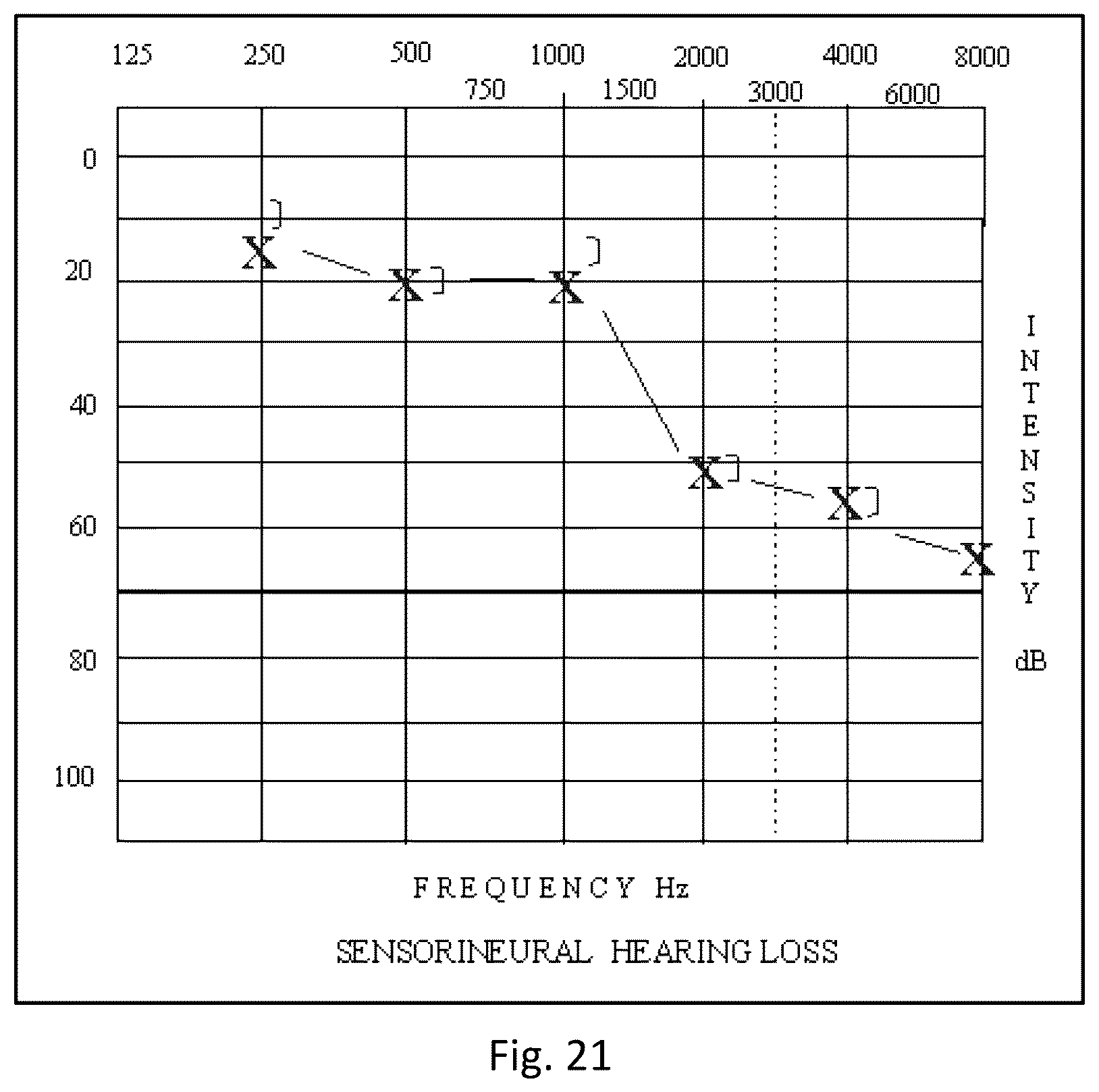 Patent US12311114 Figure 13 – Method and apparatus for treating a neurological disorder