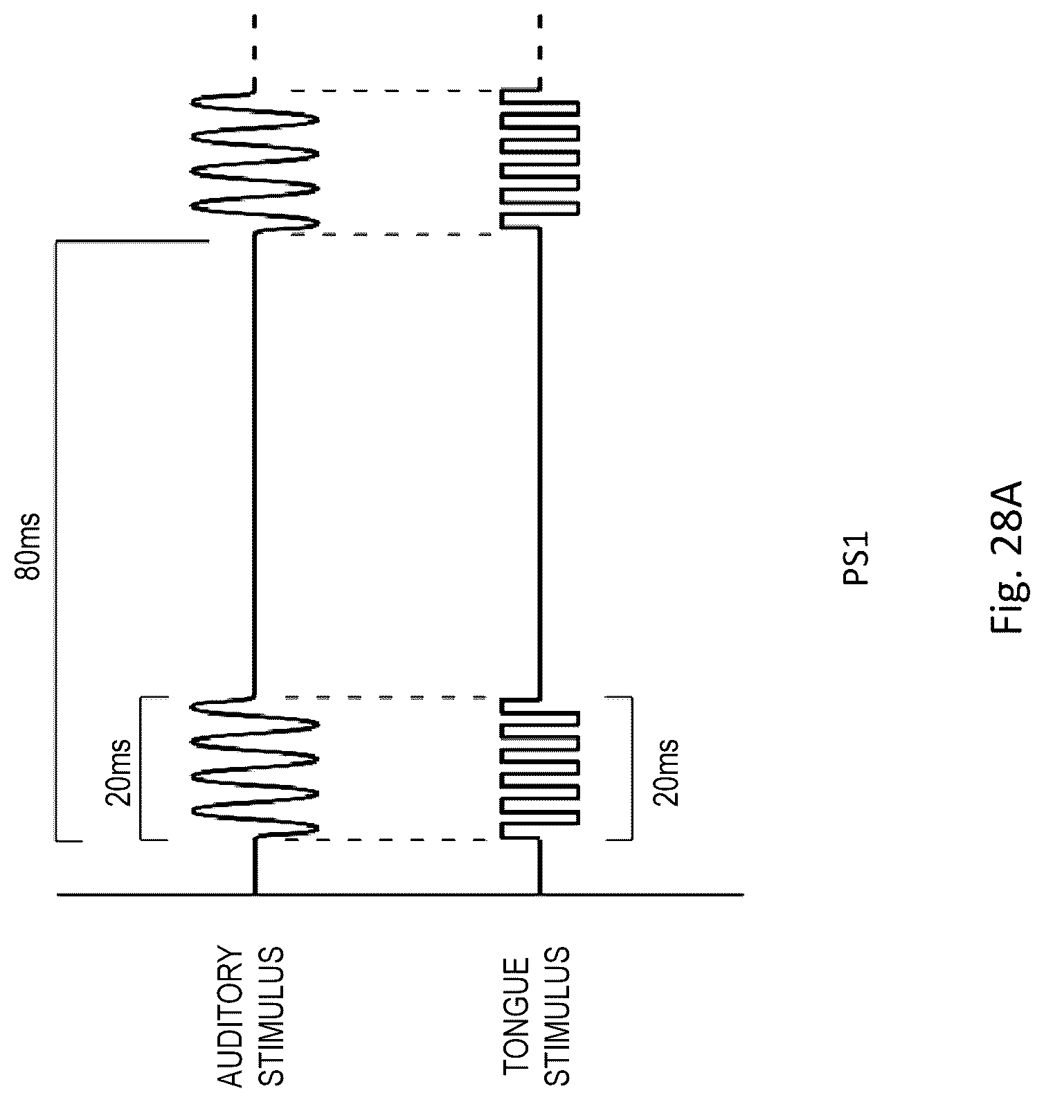 Patent US12311114 Figure 17 – Method and apparatus for treating a neurological disorder