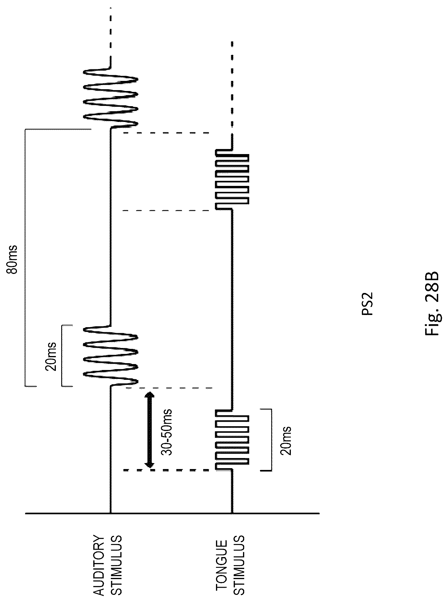 Patent US12311114 Figure 18 – Method and apparatus for treating a neurological disorder