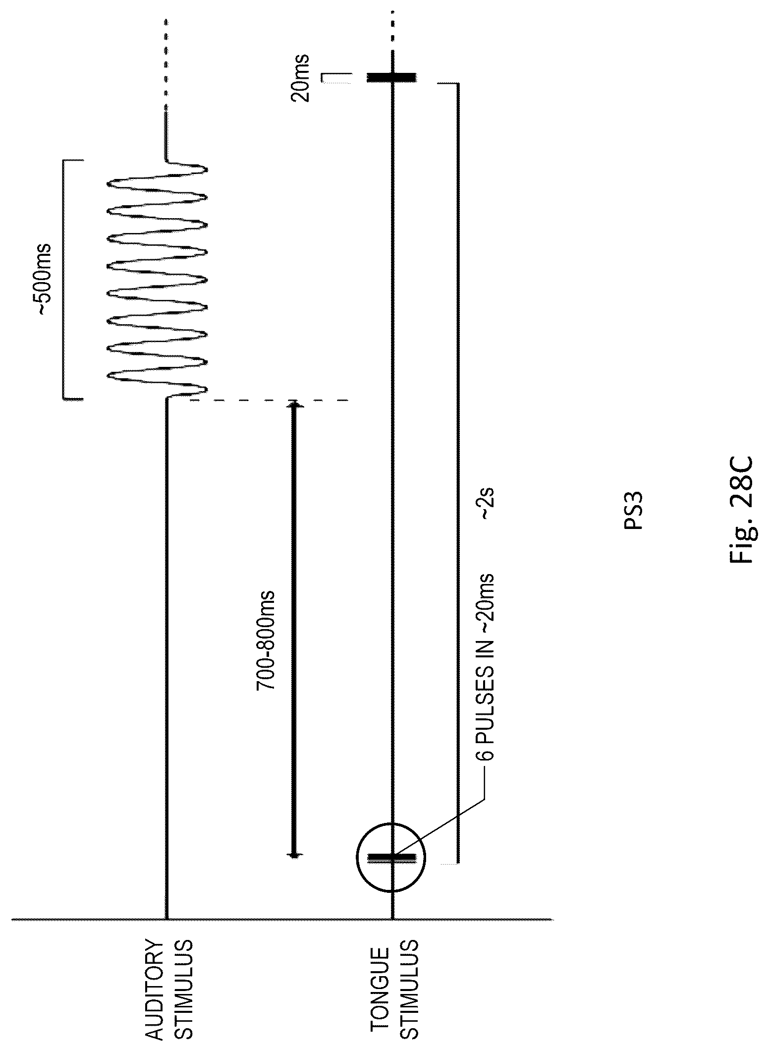 Patent US12311114 Figure 19 – Method and apparatus for treating a neurological disorder