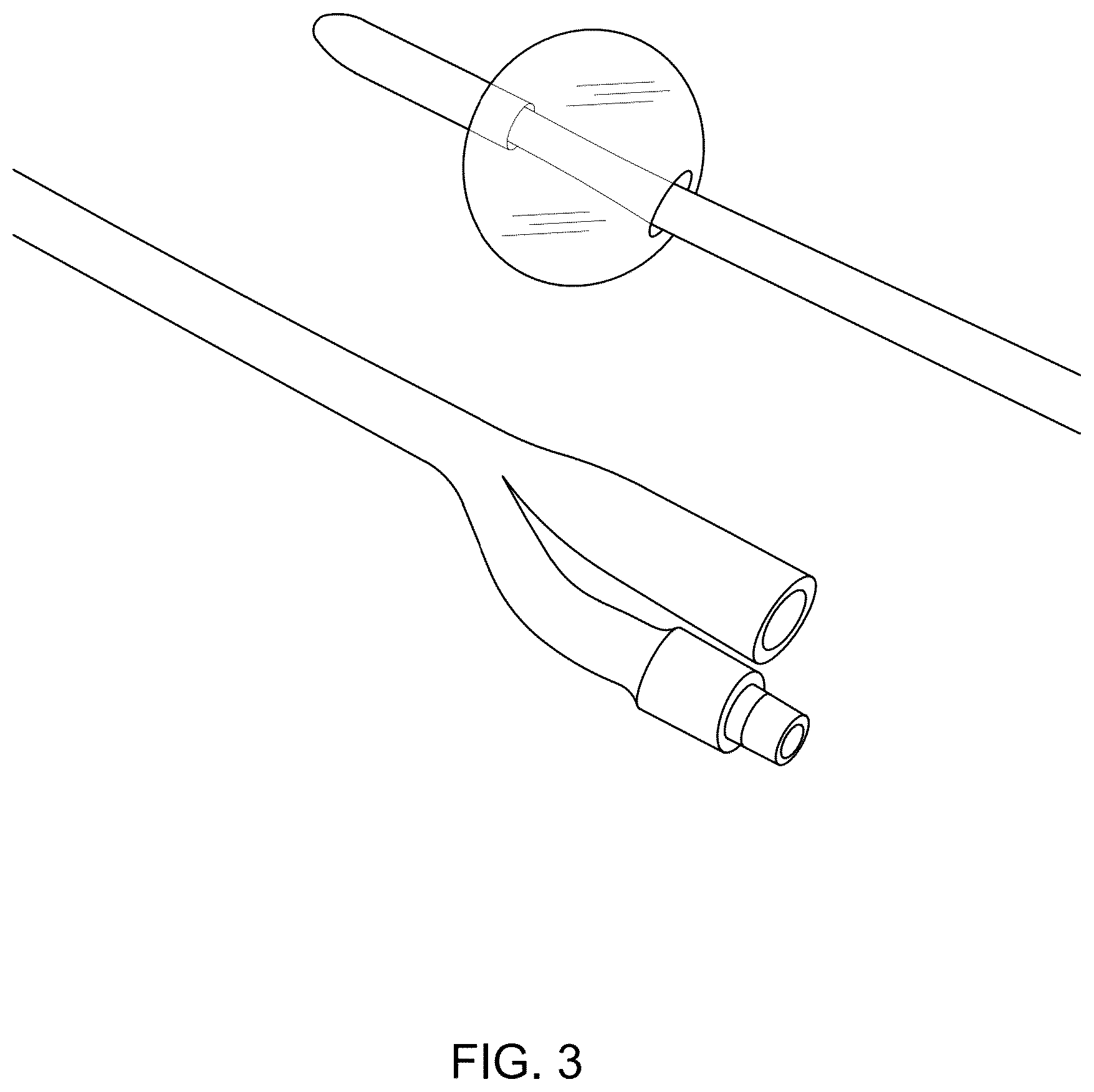 Patent US12311118 Figure 3 – Body fluid movement system