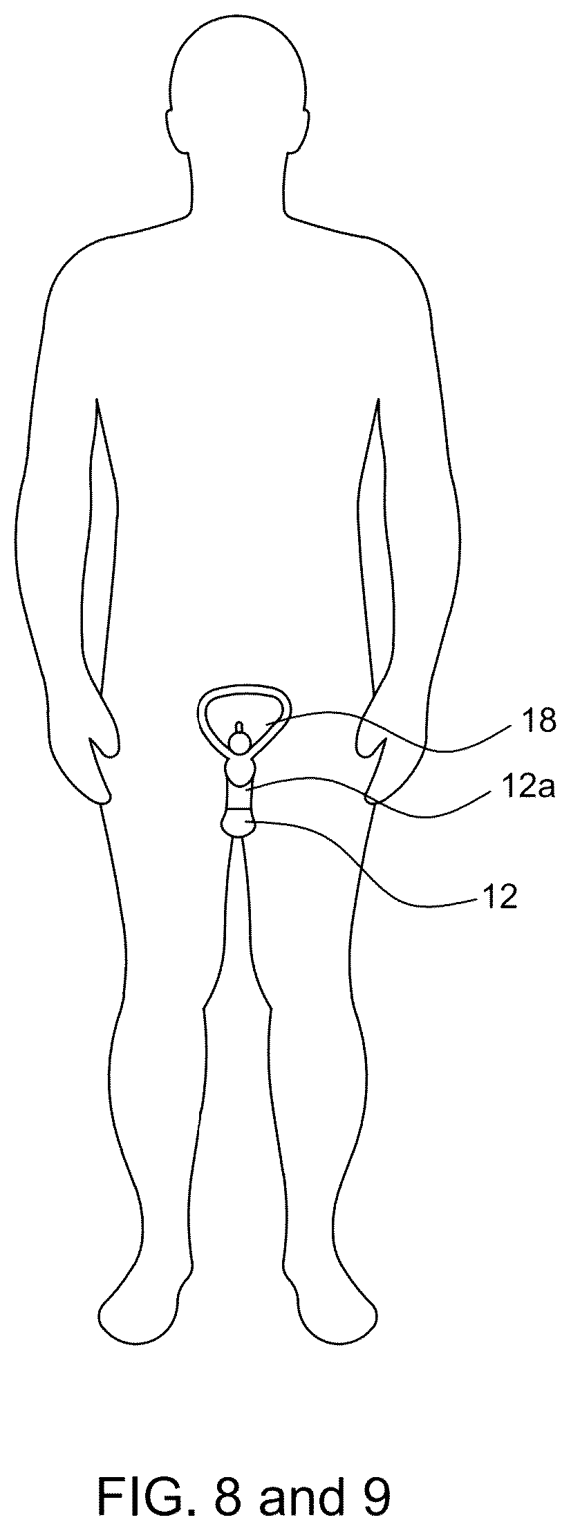 Patent US12311118 Figure 8 – Body fluid movement system
