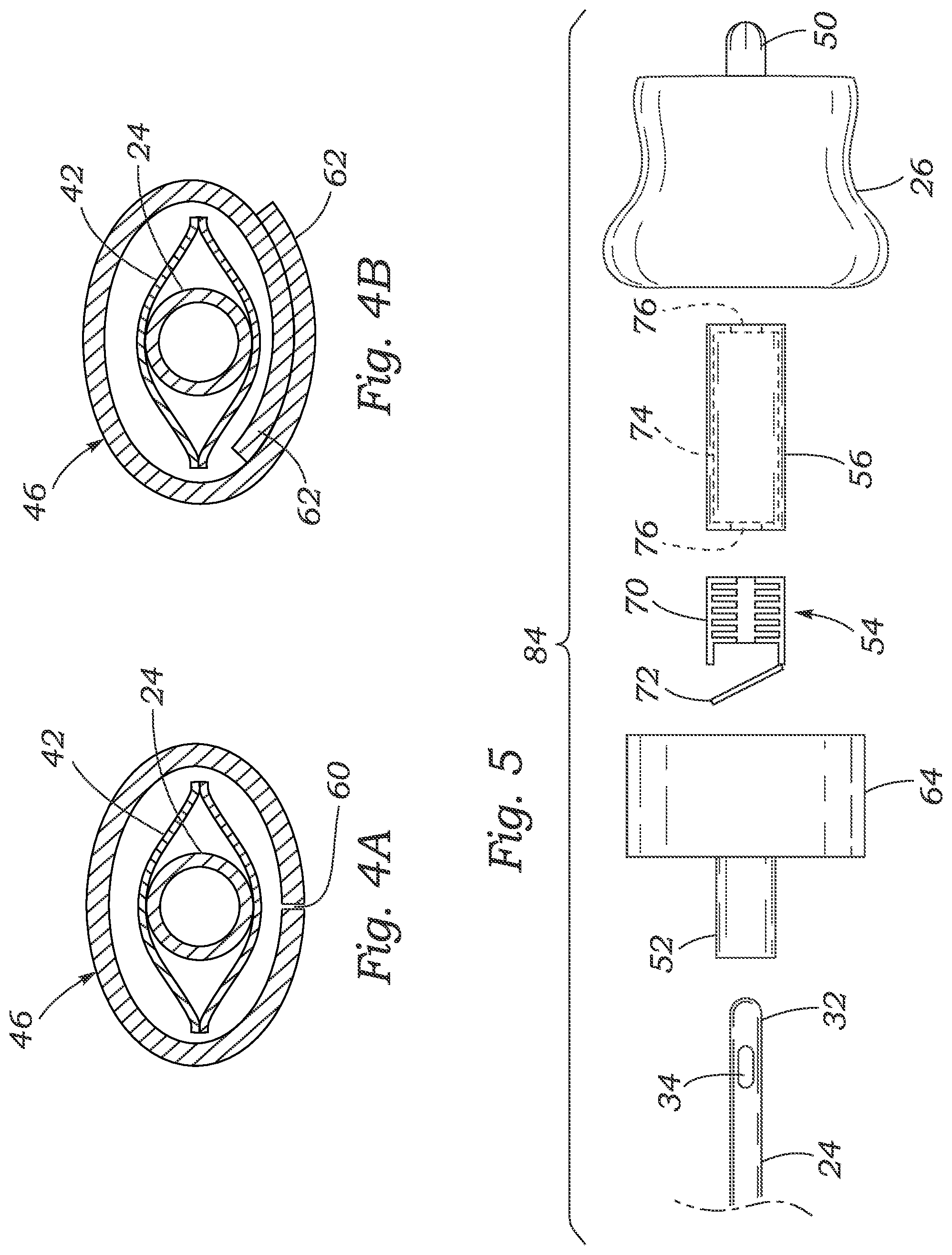 Patent US12311119 Figure 4 – Methods of urging a catheter from a closed urinary catheter system