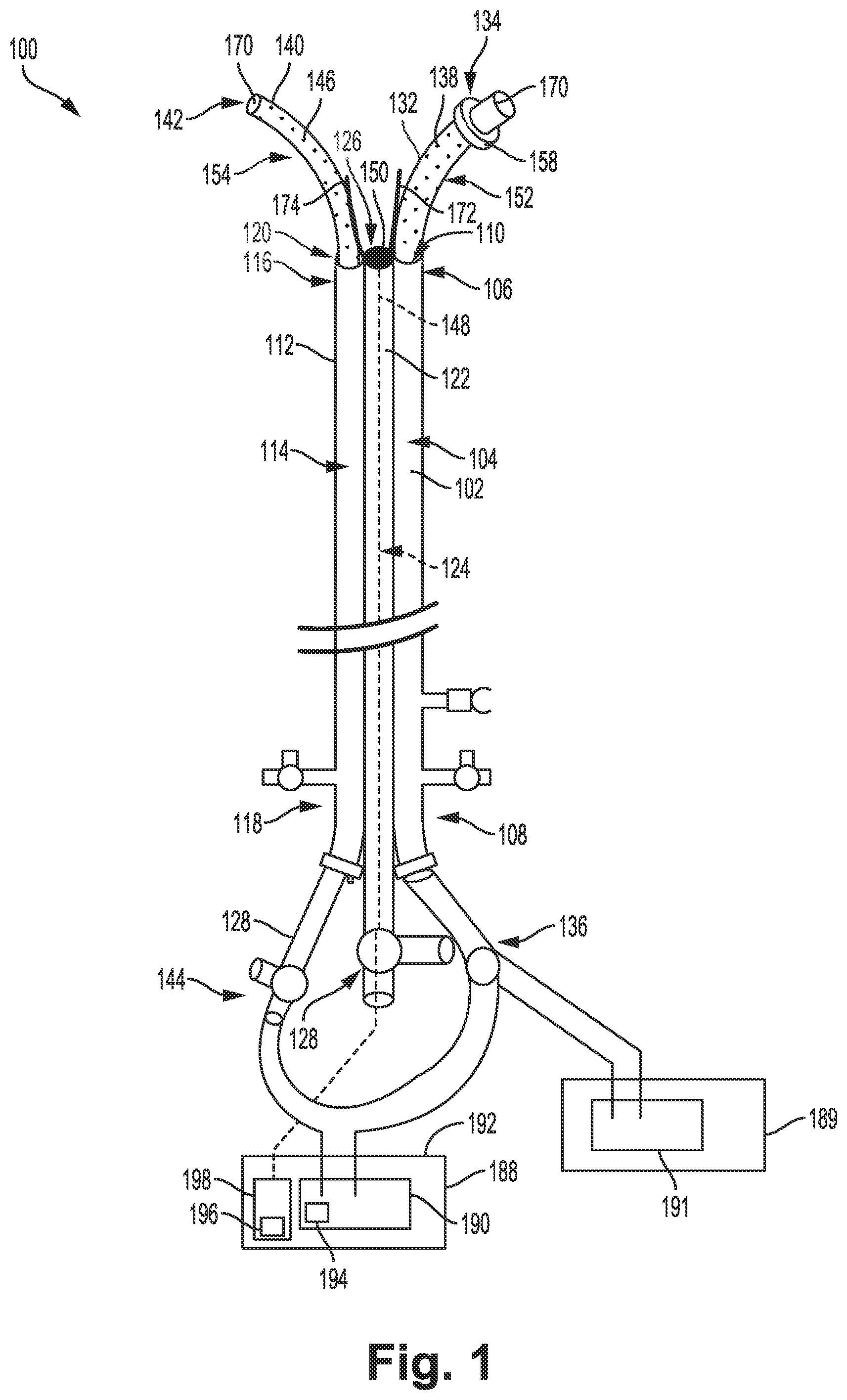 Patent US12311121 Figure 1 – Bi-lateral catheter system and methods for use