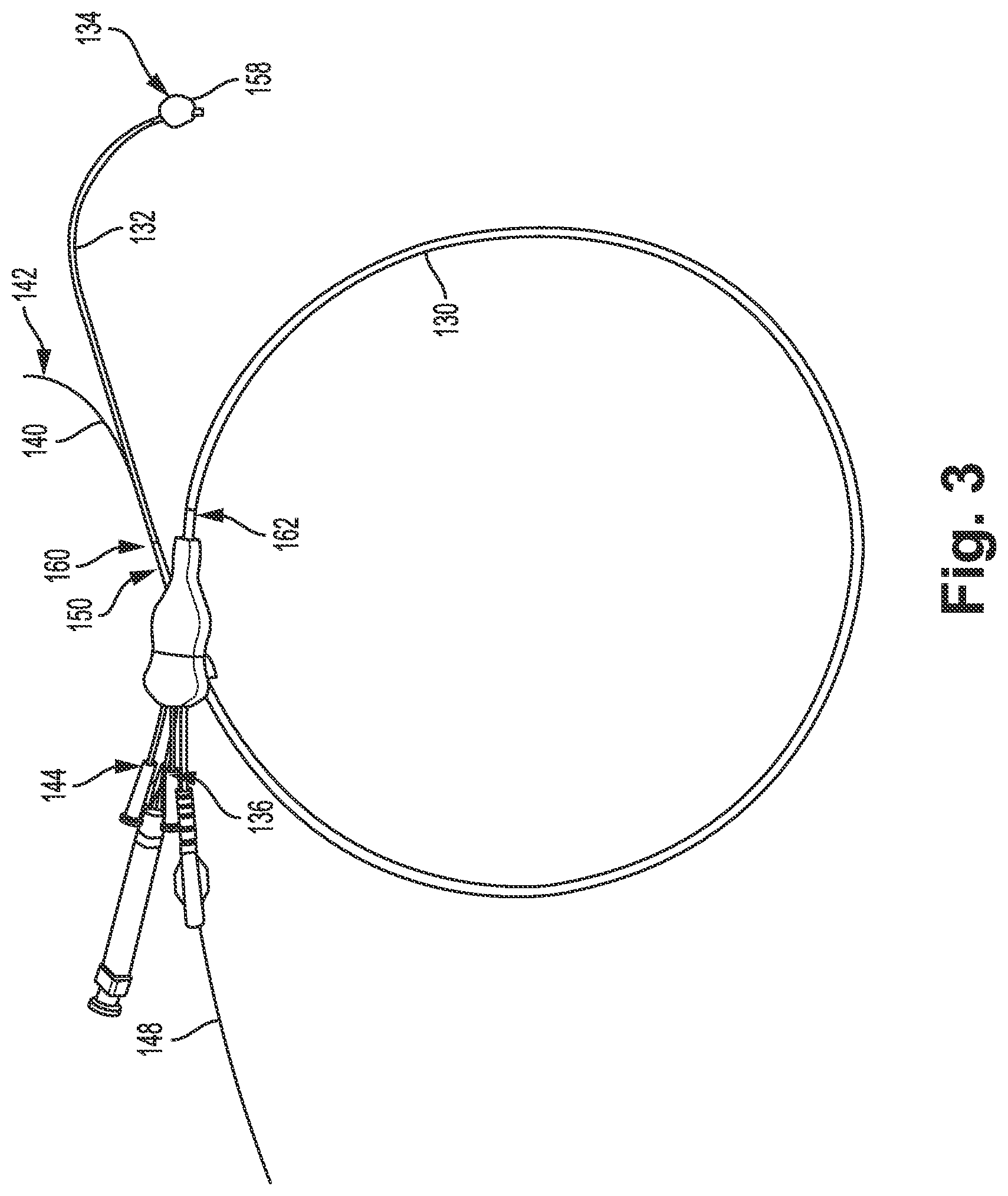 Patent US12311121 Figure 3 – Bi-lateral catheter system and methods for use