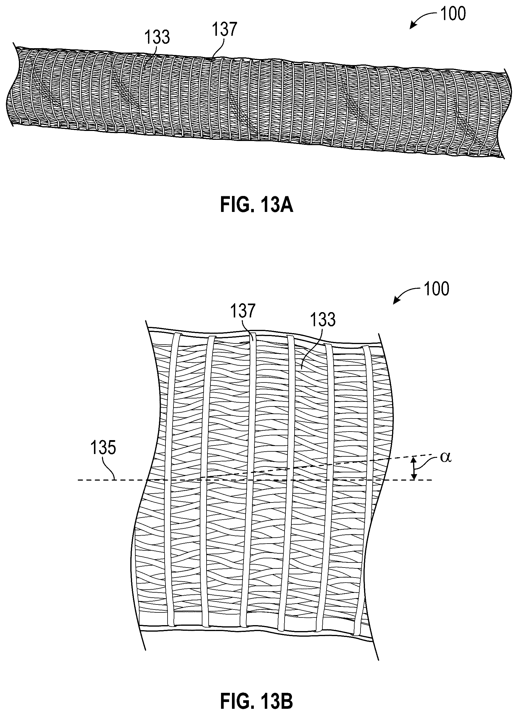 Patent US12311122 Figure 14 – Rigidizing overtube with hemostasis valve