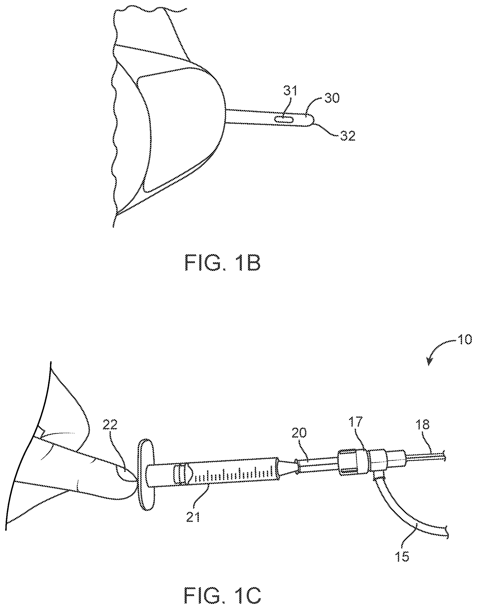 Patent US12311123 Figure 2 – Apparatus and method for everting catheter for uterine access for biopsy and cytology